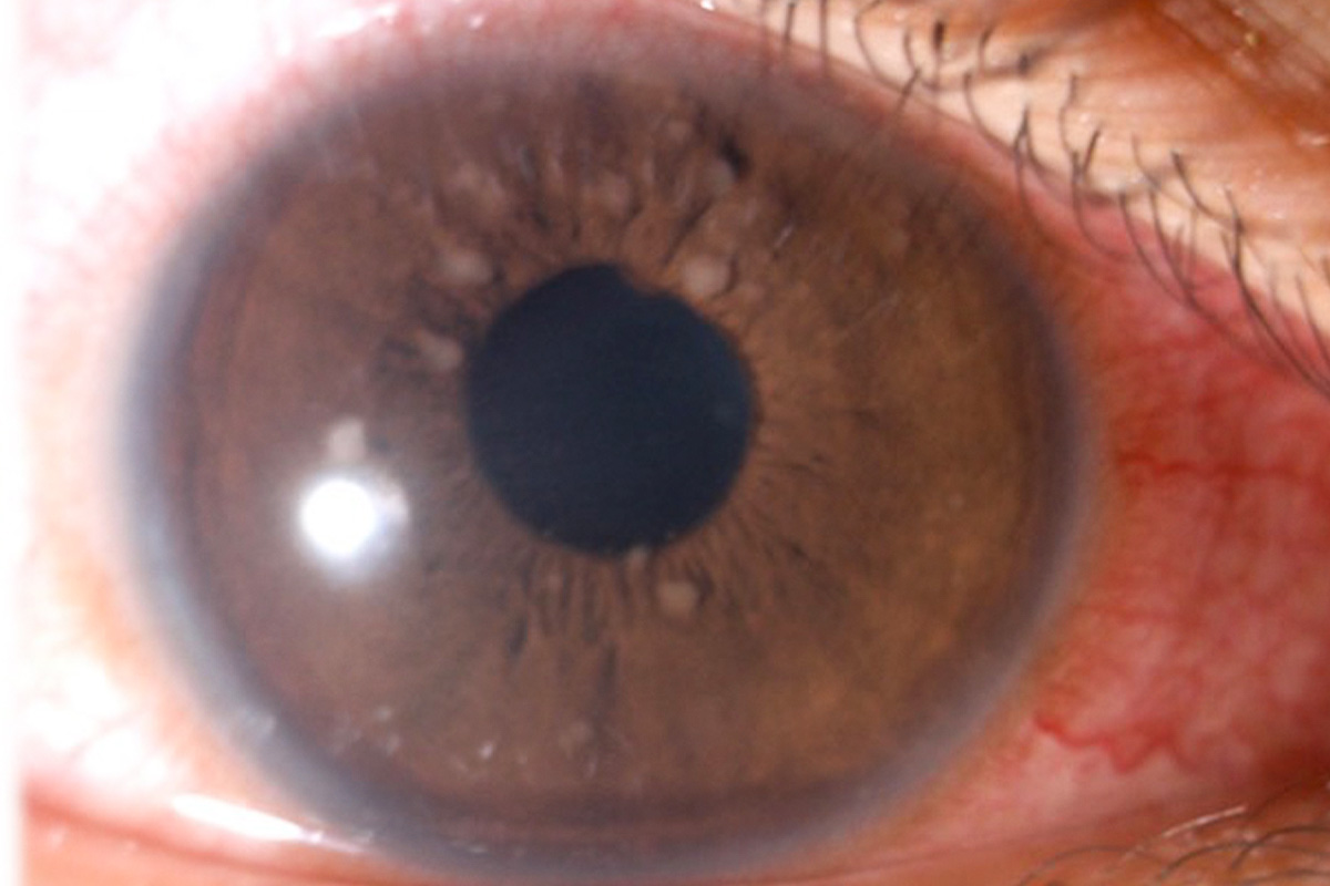 Young woman wearing glasses smiles