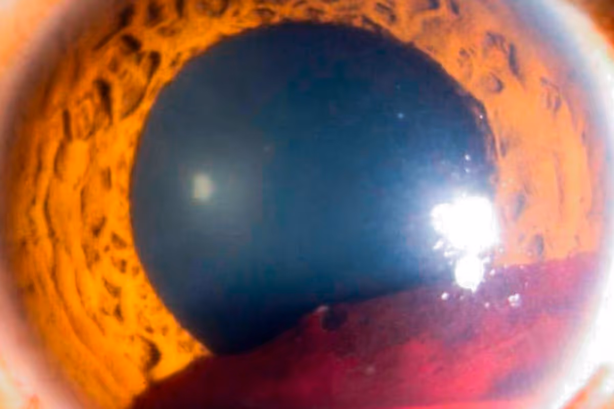 Young woman wearing glasses smiles