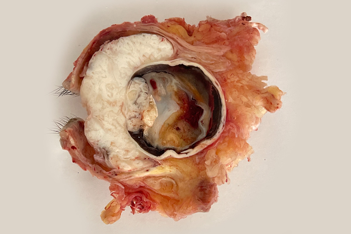 Young woman wearing glasses smiles