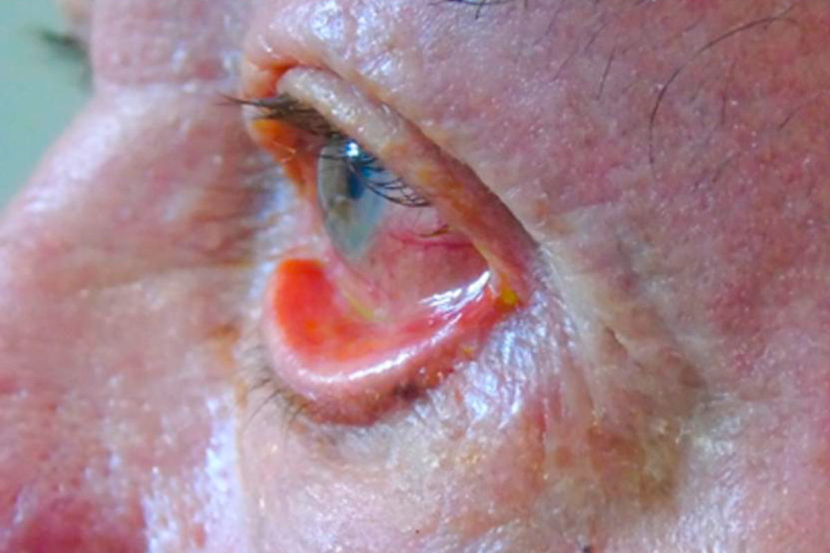 Young woman wearing glasses smiles