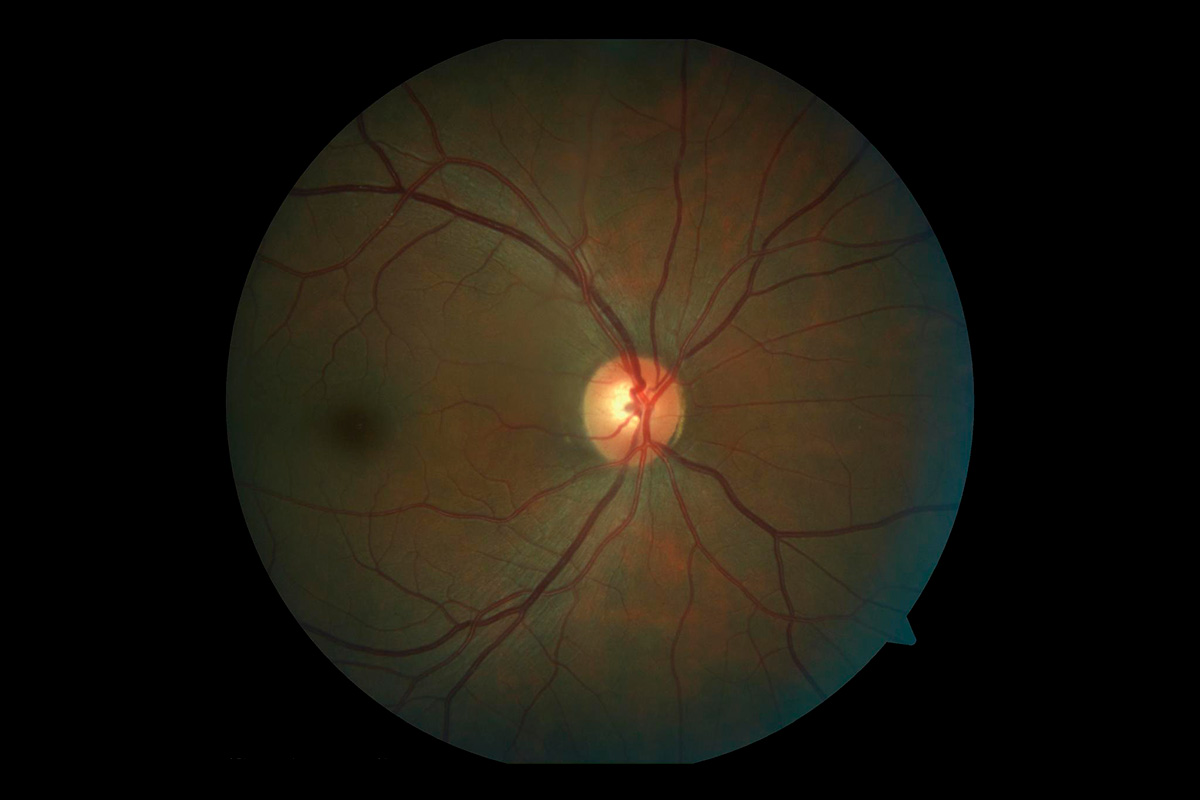 Young woman wearing glasses smiles