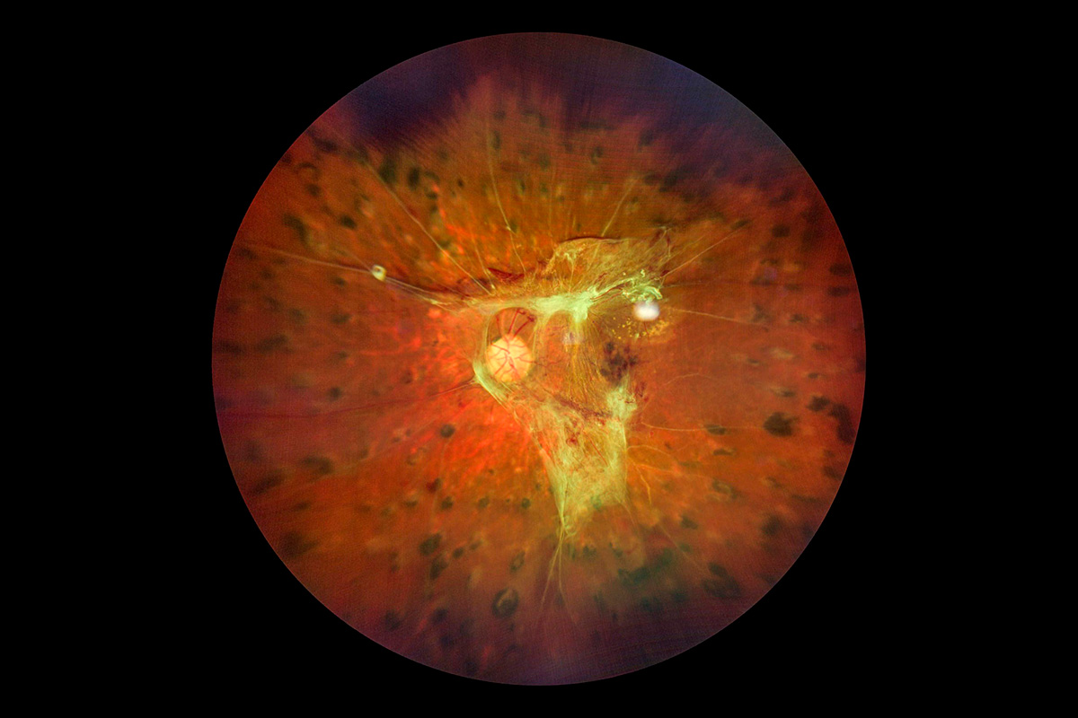 Young woman wearing glasses smiles