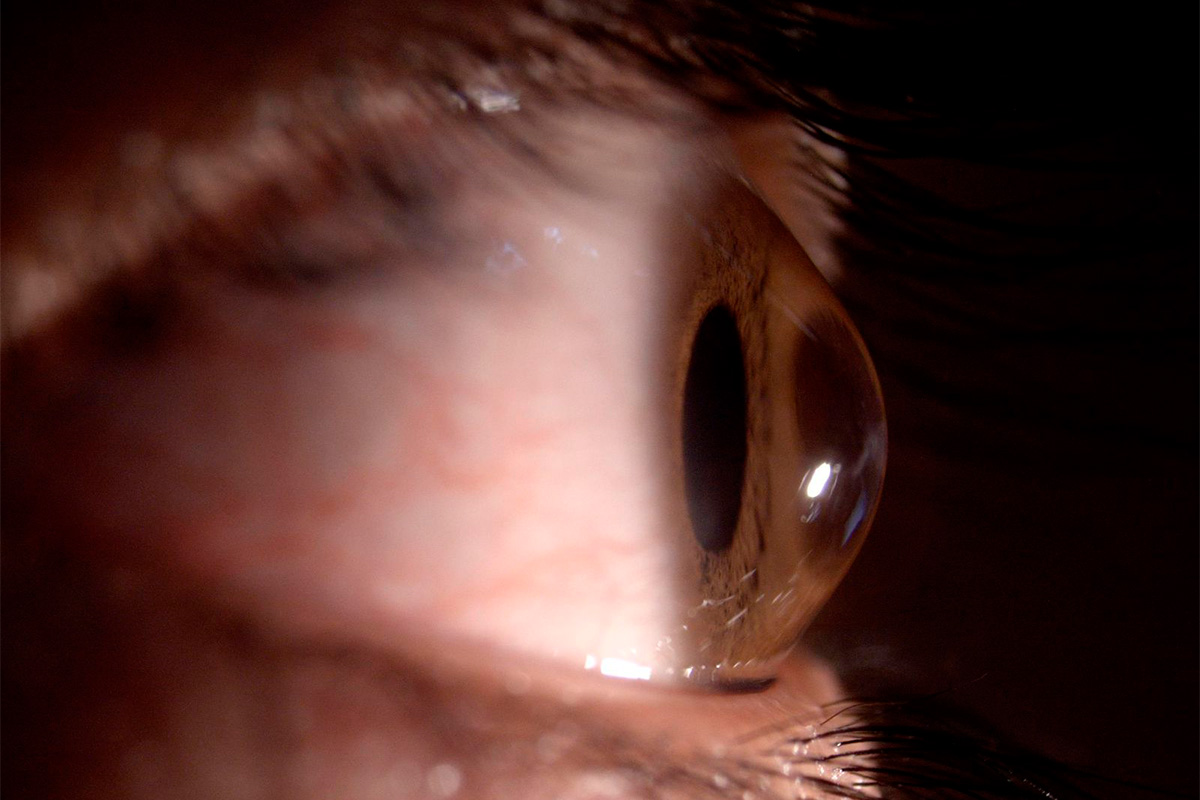 Young woman wearing glasses smiles