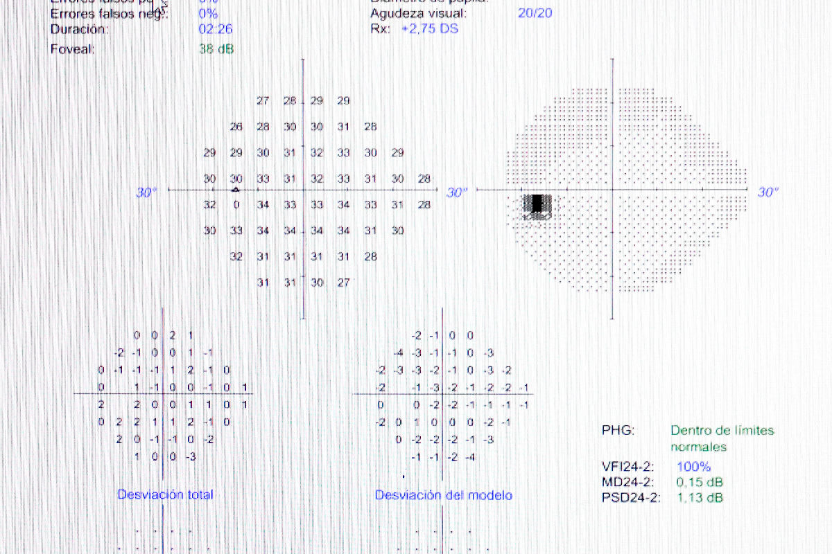 Young woman wearing glasses smiles