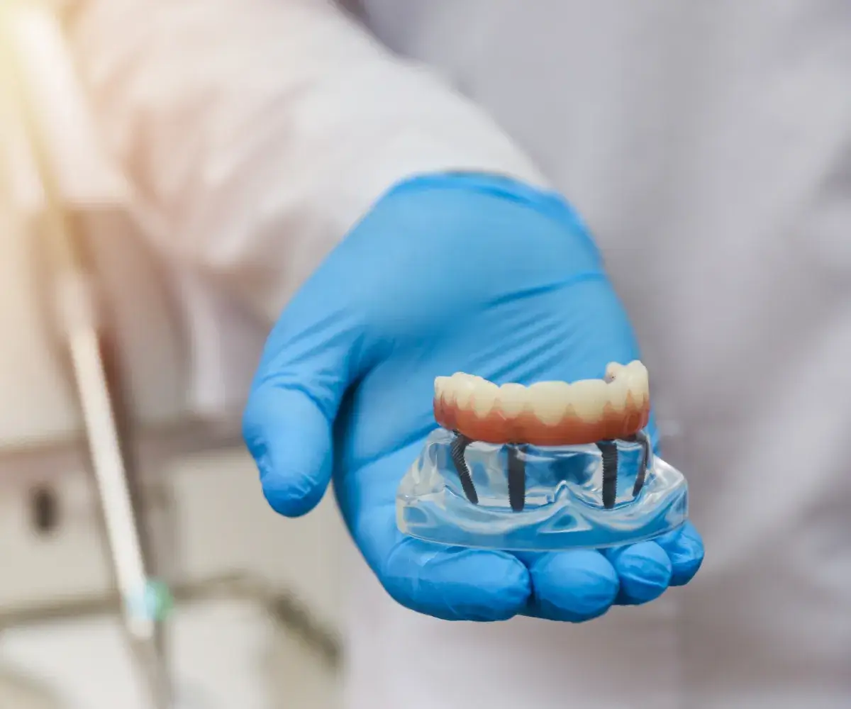 A person in blue gloves holding a fake tooth.