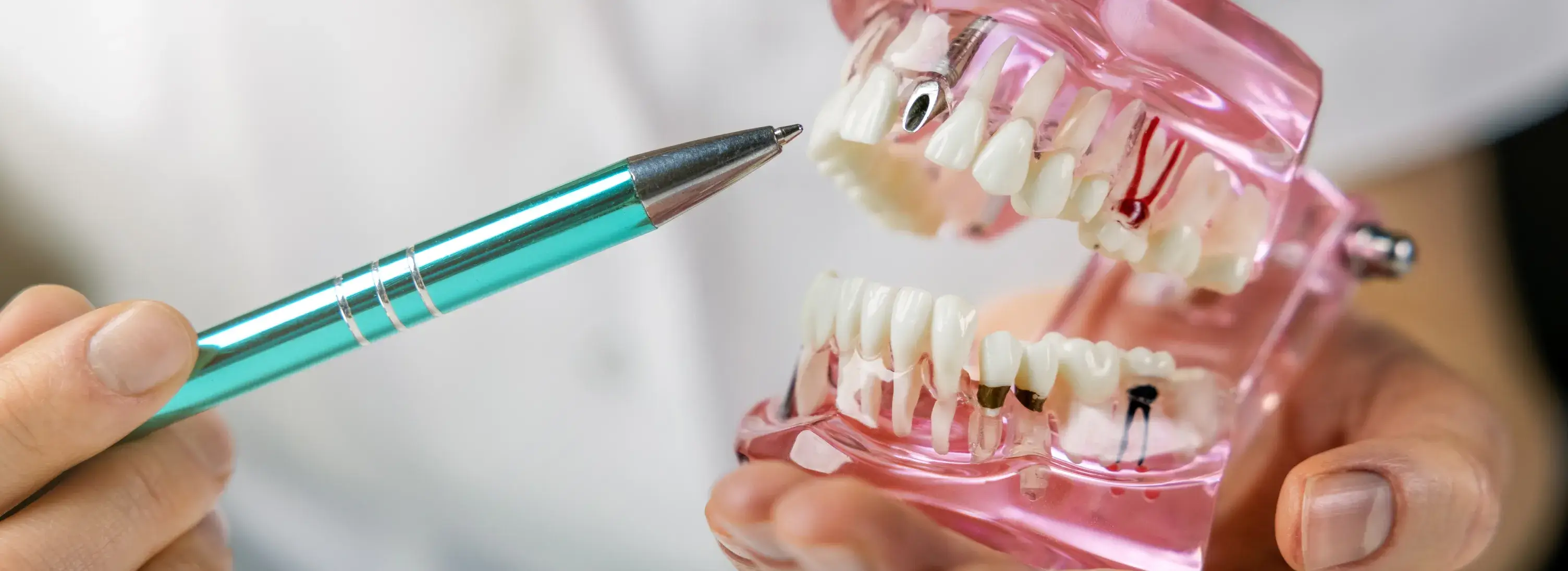 A person holding a pen and a toothbrush in their hands.