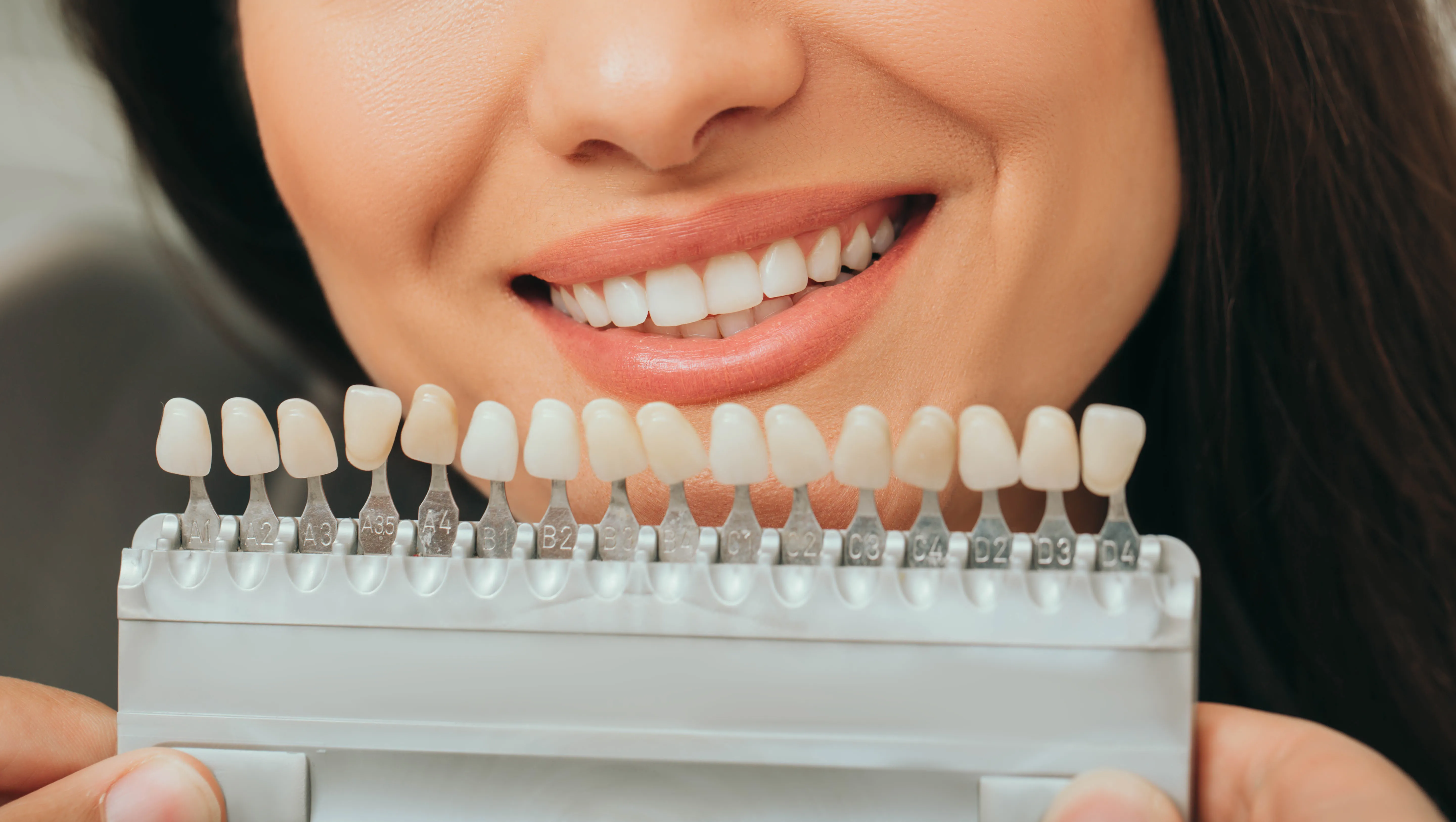 Smiling woman holding a tooth shade guide in front of her mouth to select the perfect color match for teeth whitening or veneer treatment in a cosmetic dental clinic