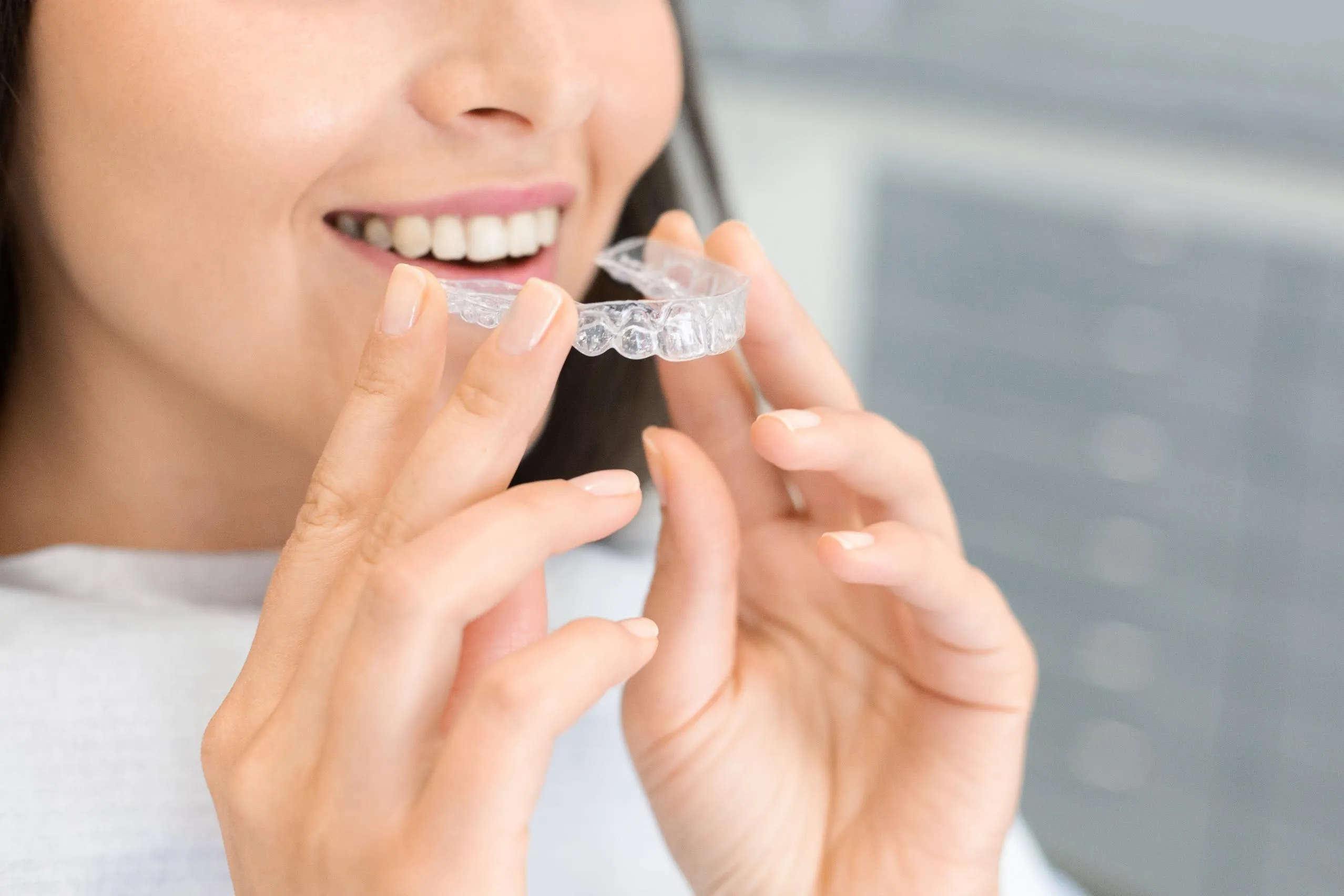 Close-up of a woman smiling and holding a pair of transparent Invisalign aligners in her hands representing modern, discreet orthodontic treatment