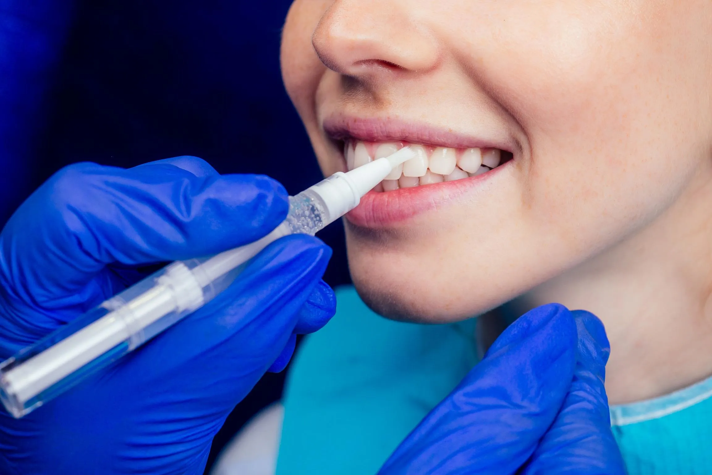 Close-up of dentist’s gloved hands using a handheld laser cleaning device to polish and whiten a patient’s teeth during a cosmetic dental treatment