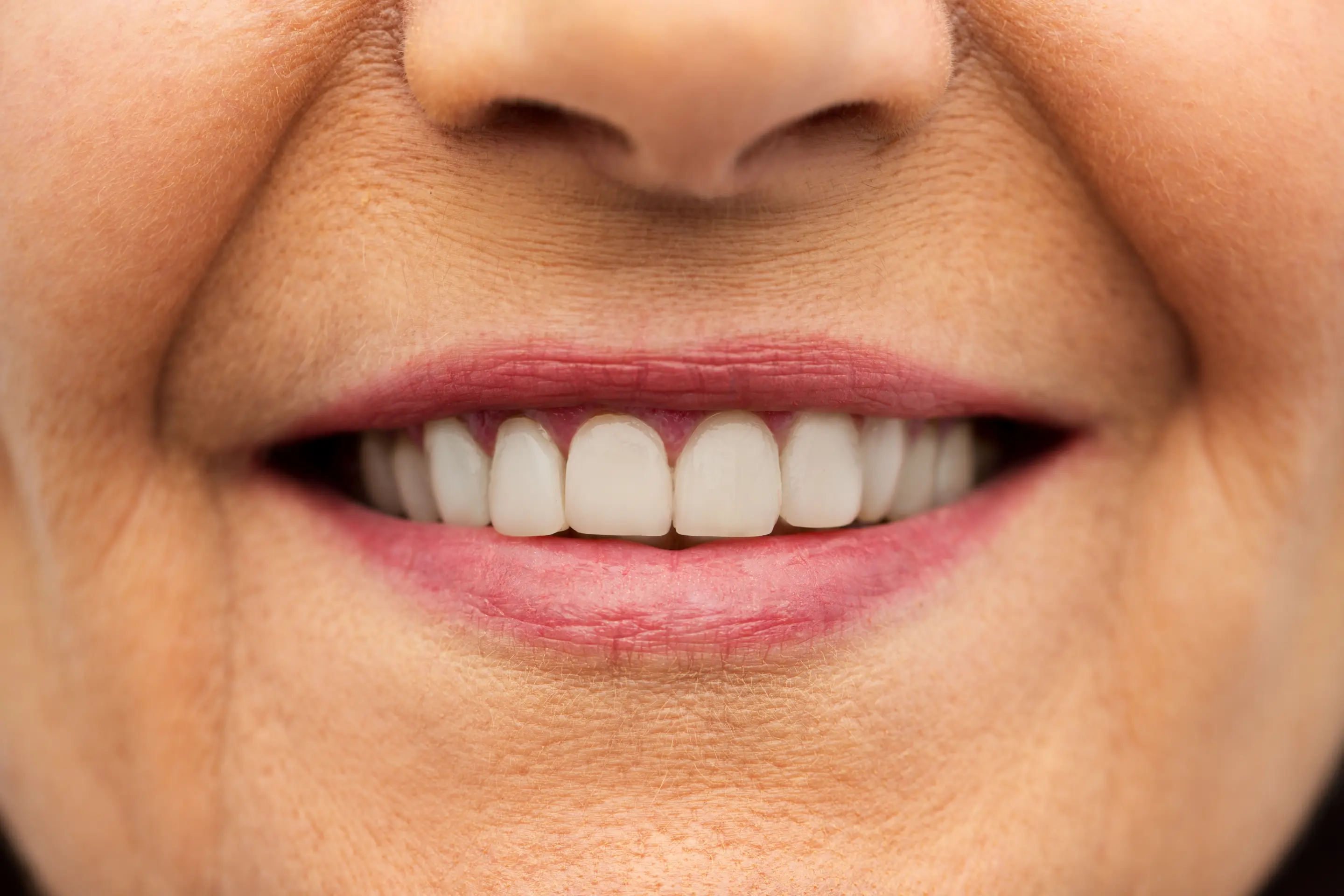 Close-up of a mature patient’s healthy smile showing bright white teeth after professional dental cleaning and cosmetic restoration treatment