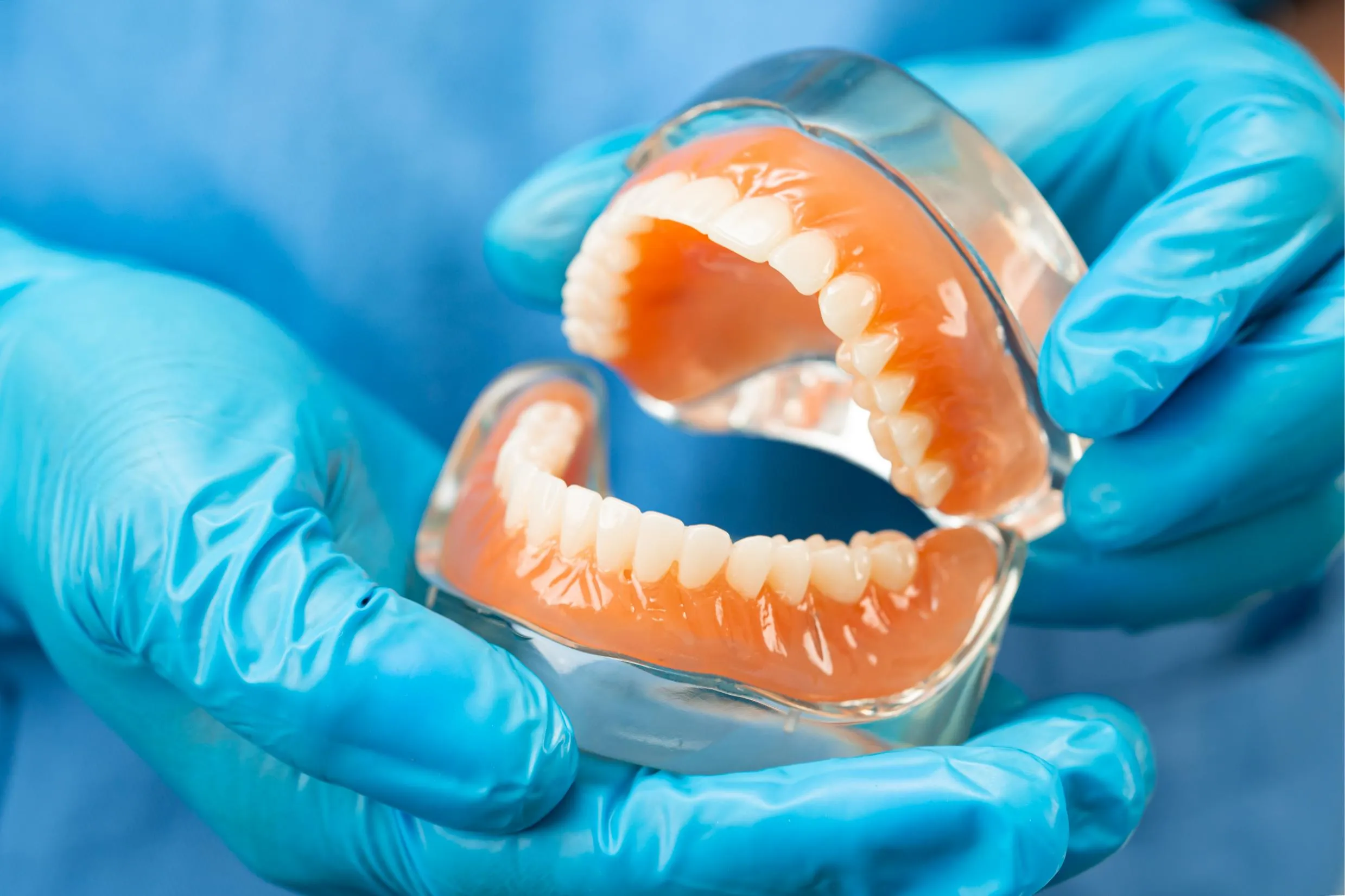 Dentist wearing blue medical gloves holding a full set of dentures carefully to show their structure and design used for complete tooth replacement solutions