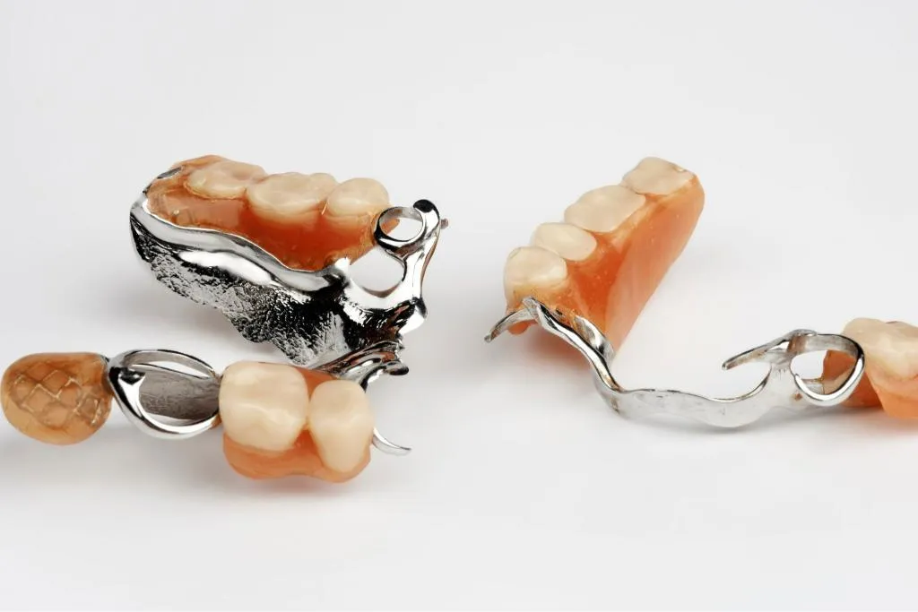 Close-up of metal and acrylic partial dentures showing precision clasps and replacement teeth used for restoring smiles and improving chewing function