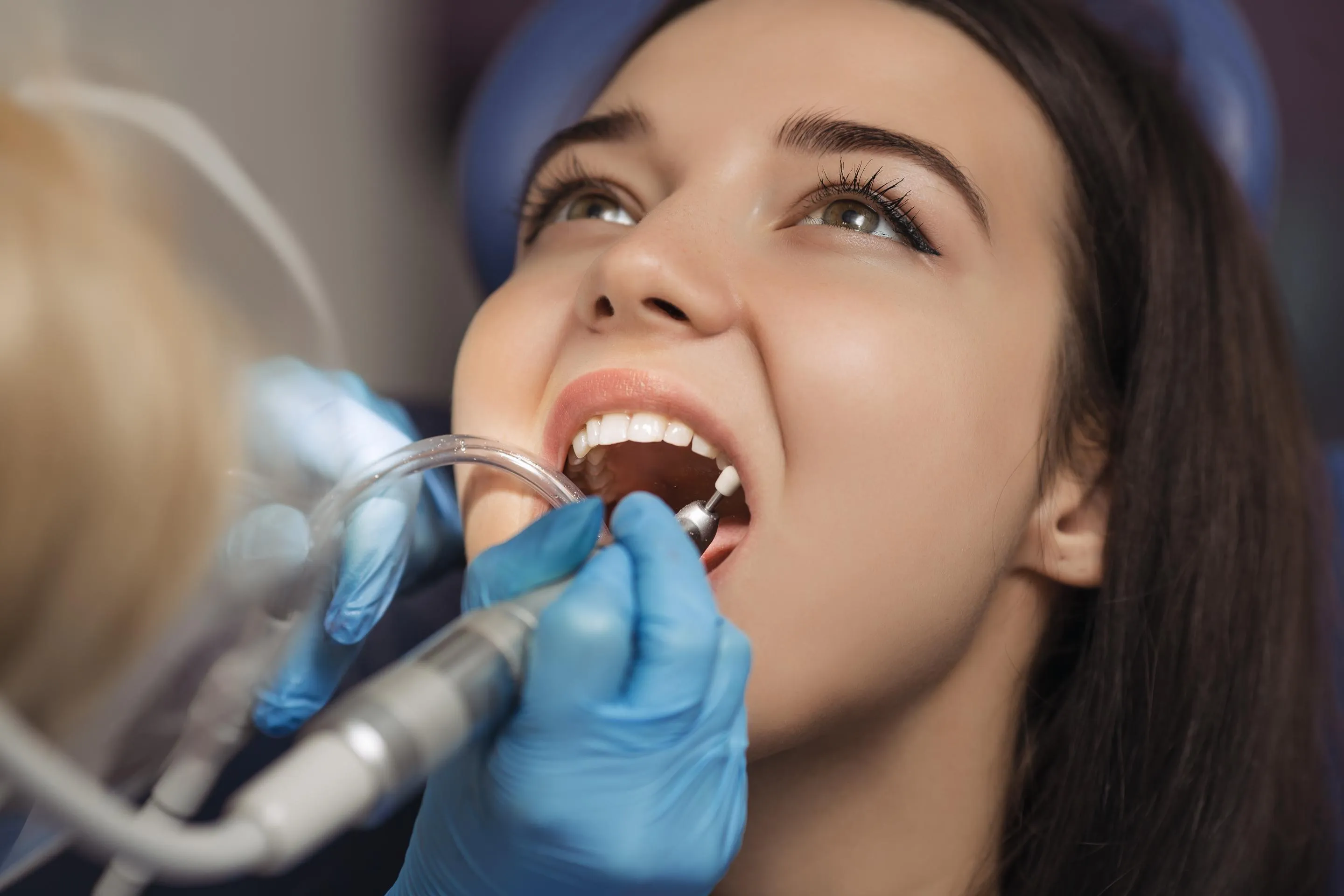 Female patient opening her mouth during a dental checkup while the dentist uses a mirror and dental tools to examine her teeth in a clean, modern dental clinic