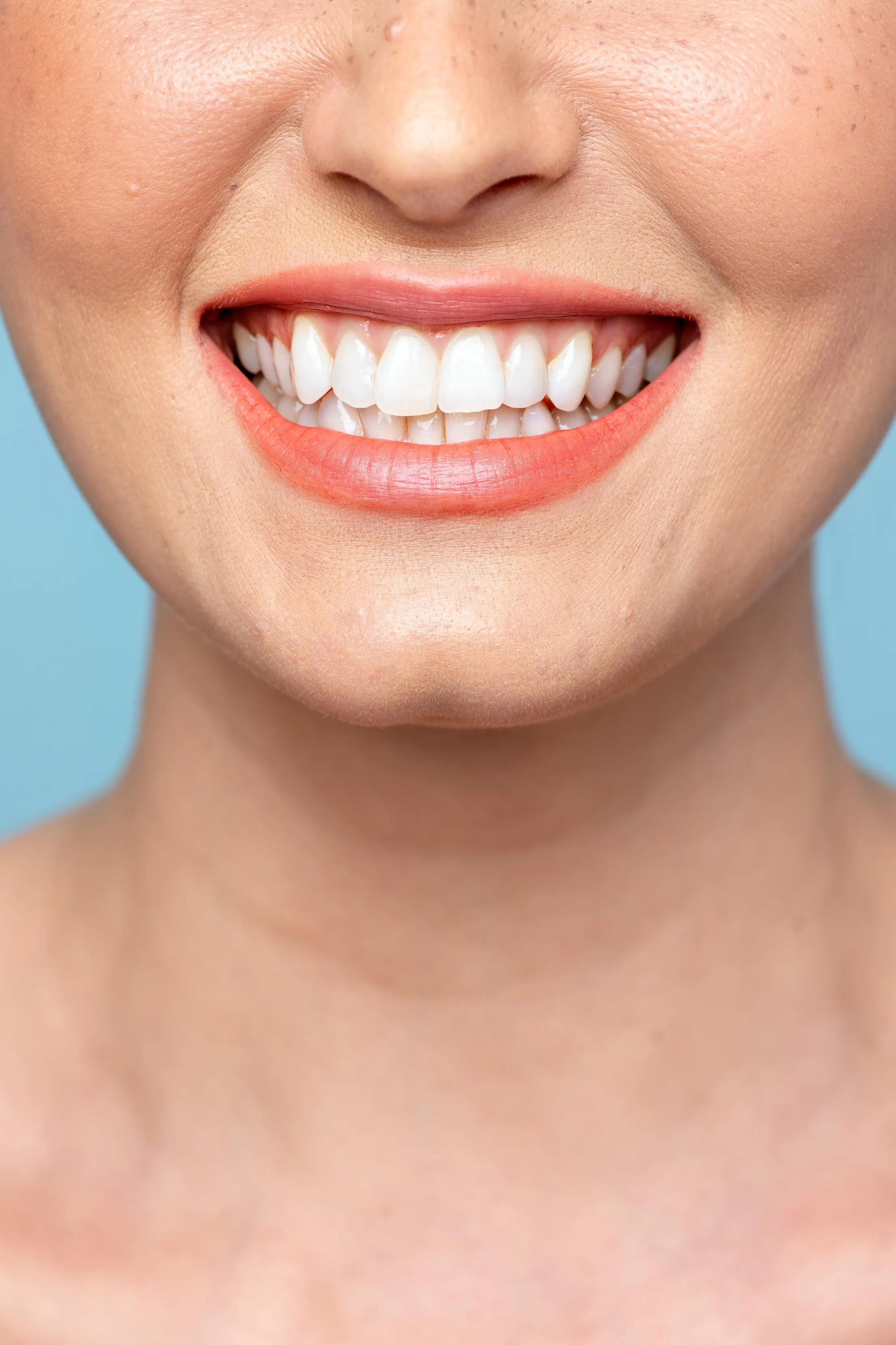 Close-up of a bright white smile showing perfectly aligned teeth after professional dental whitening and orthodontic treatment representing aesthetic and cosmetic dentistry success