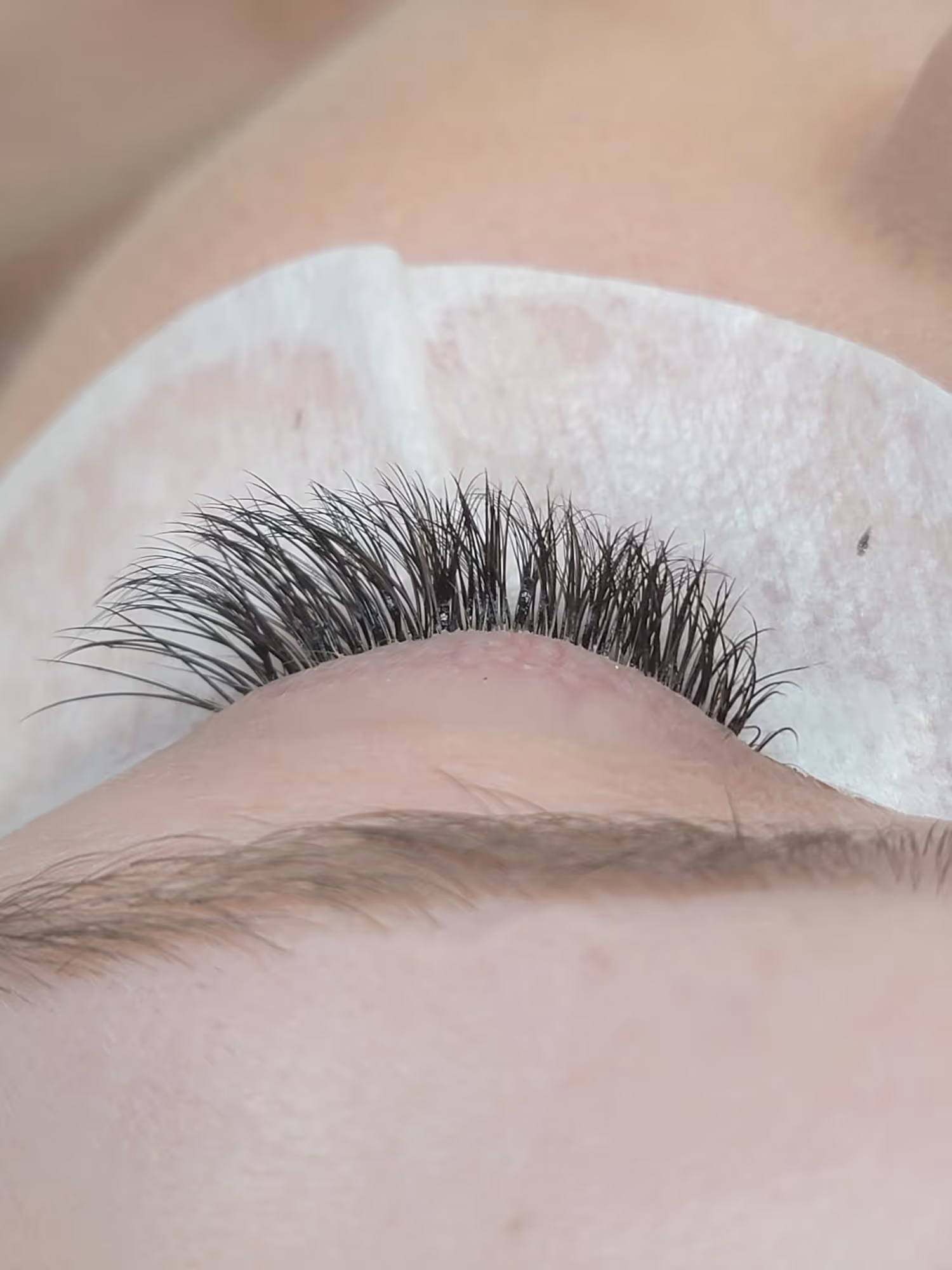 Close-up of an eye with long, thick eyelash extensions and a protective white pad underneath.
