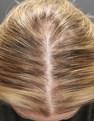 Before and after images