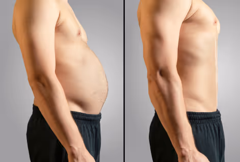 Before and after results showing reduced belly fat and improved physique, highlighting Gameday Men's Health commitment to effective treatments and results.