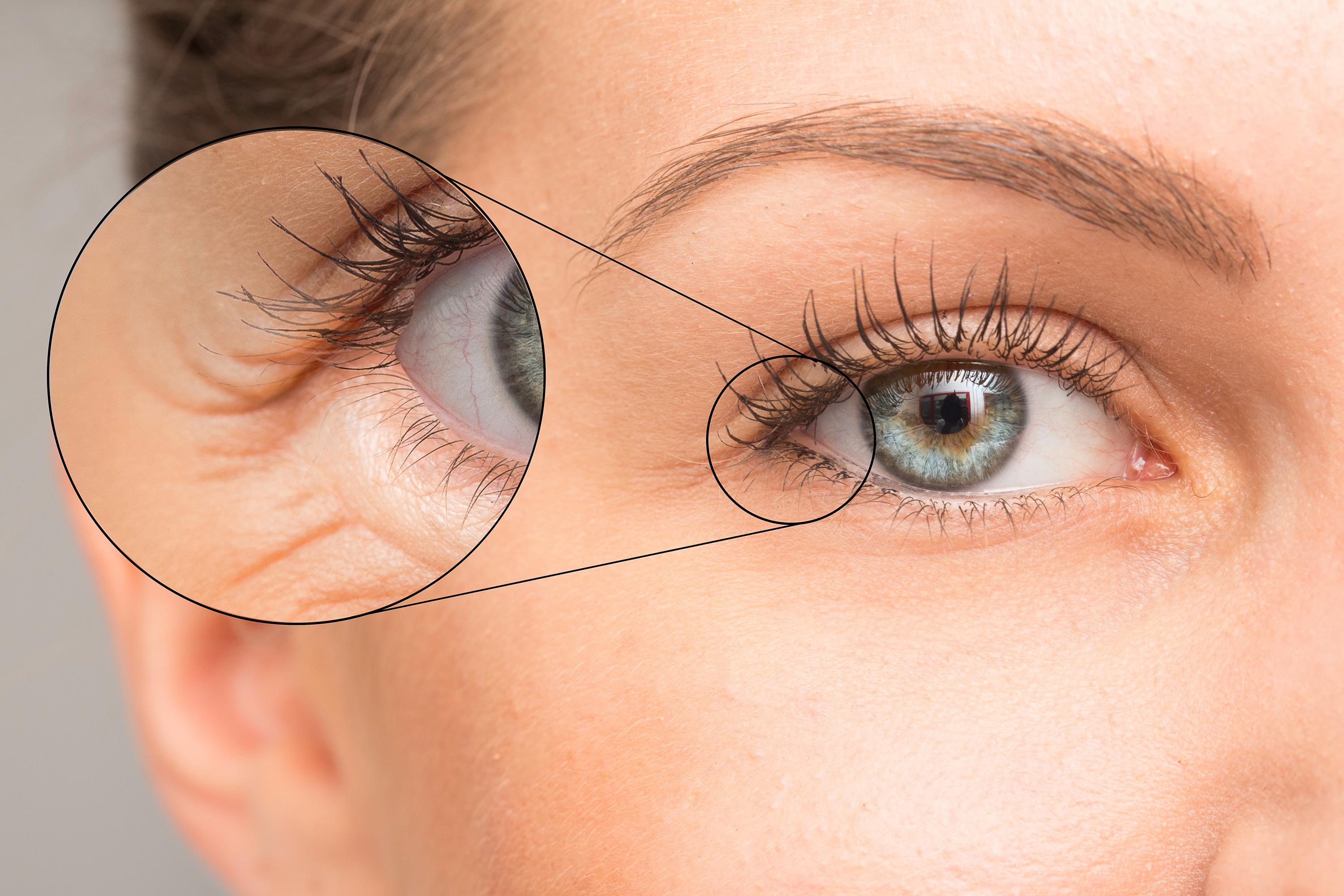 En kvinne som viser frem rynker og linjer i pannen.