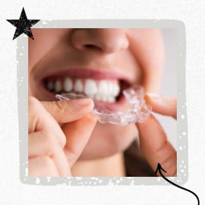 girl putting in clear aligner