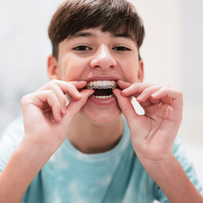 Teenage boy inserting clear aligners over his teeth, representingTeen Orthodontics