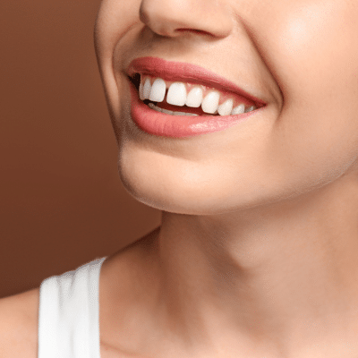 Closeup of a person's teeth, showing gaps in the front teeth