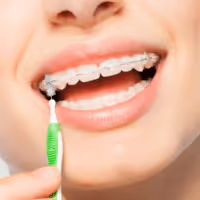 Closeup of a person cleaning their braces with a small toothbrush, representing products for cleaning and maintaining your braces