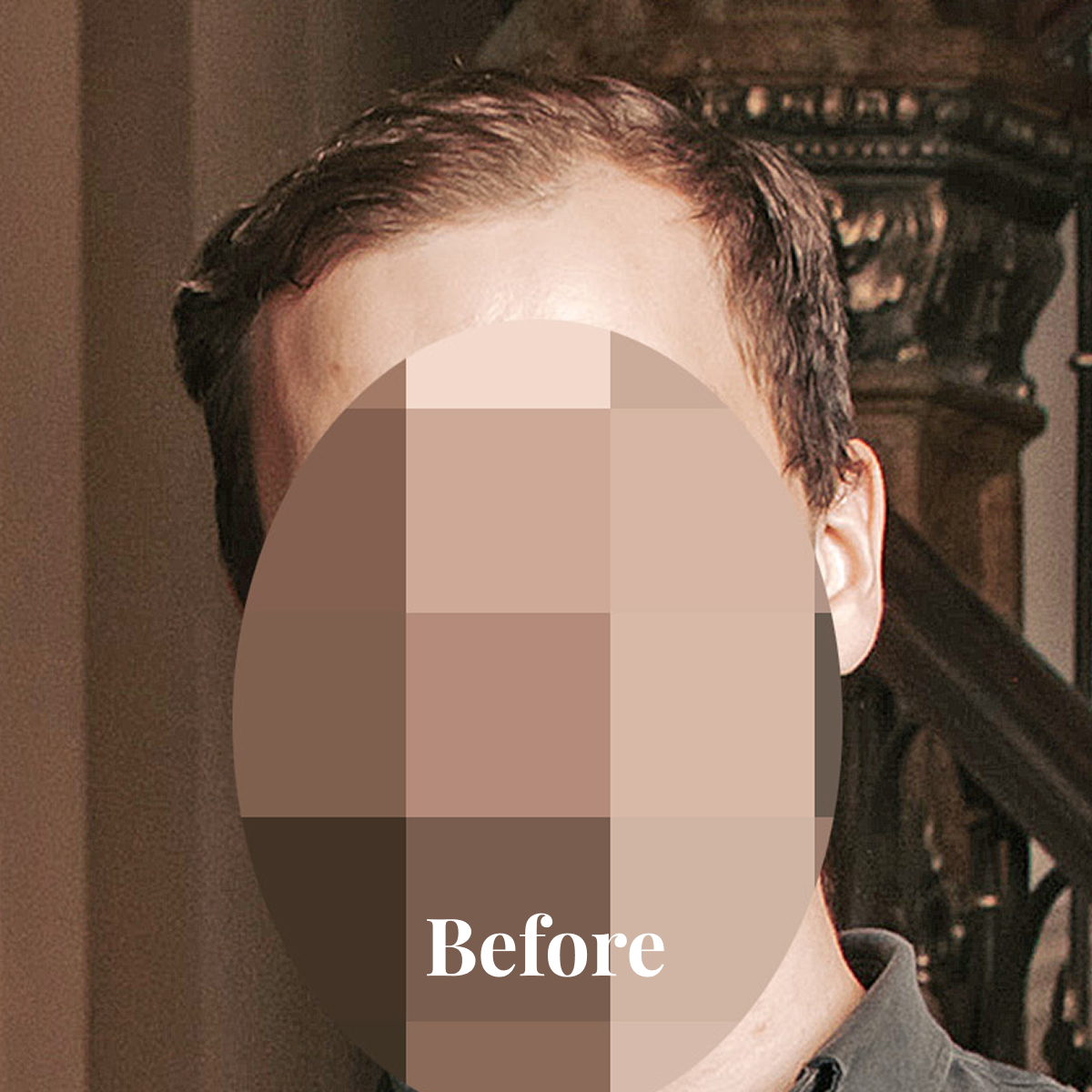 Man with short brown hair, wearing a dark collared shirt, in an indoor setting with a staircase in the background, face pixelated with 'Before' text.