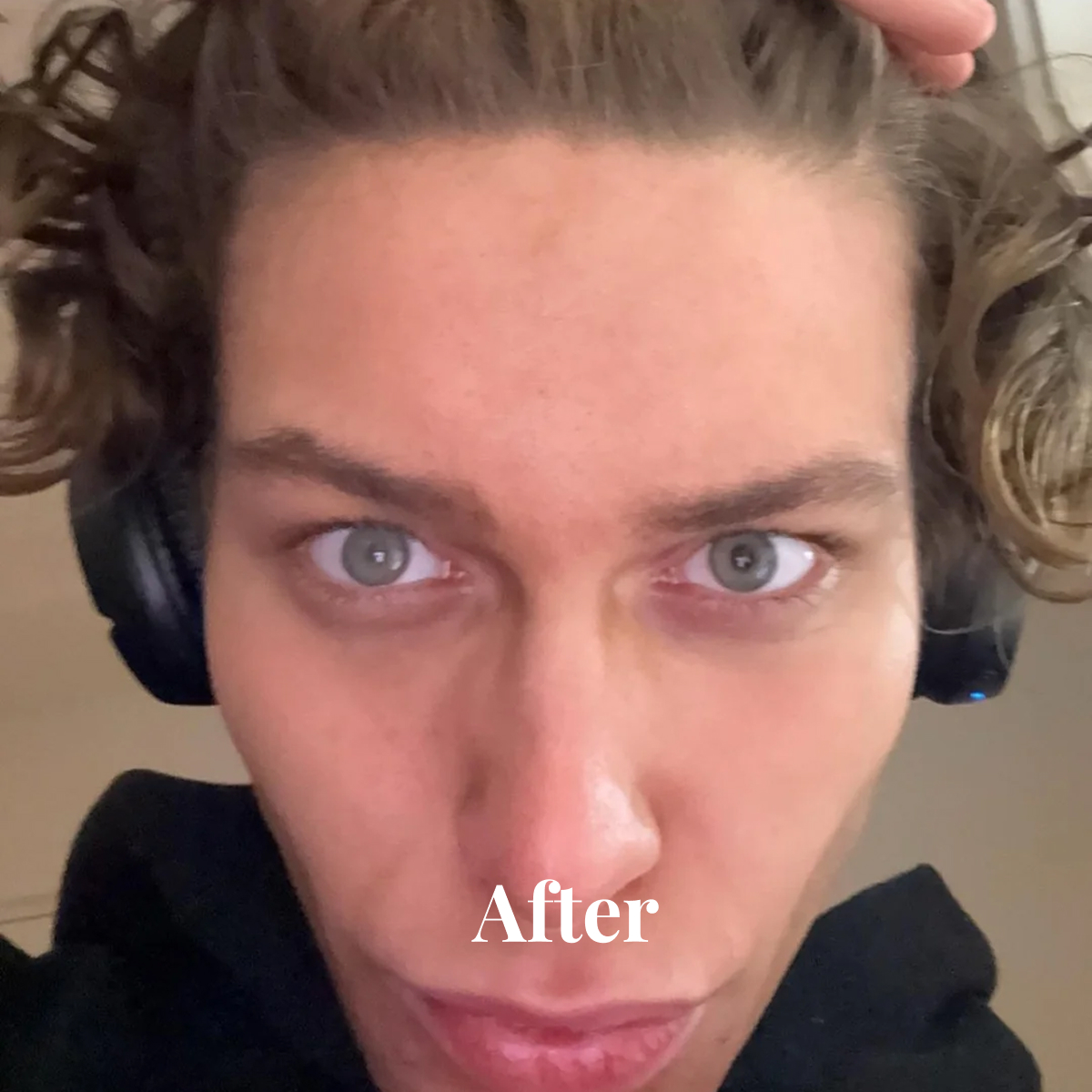 Close-up of a person with curly hair wearing black headphones and a black hoodie, captioned 'After'.