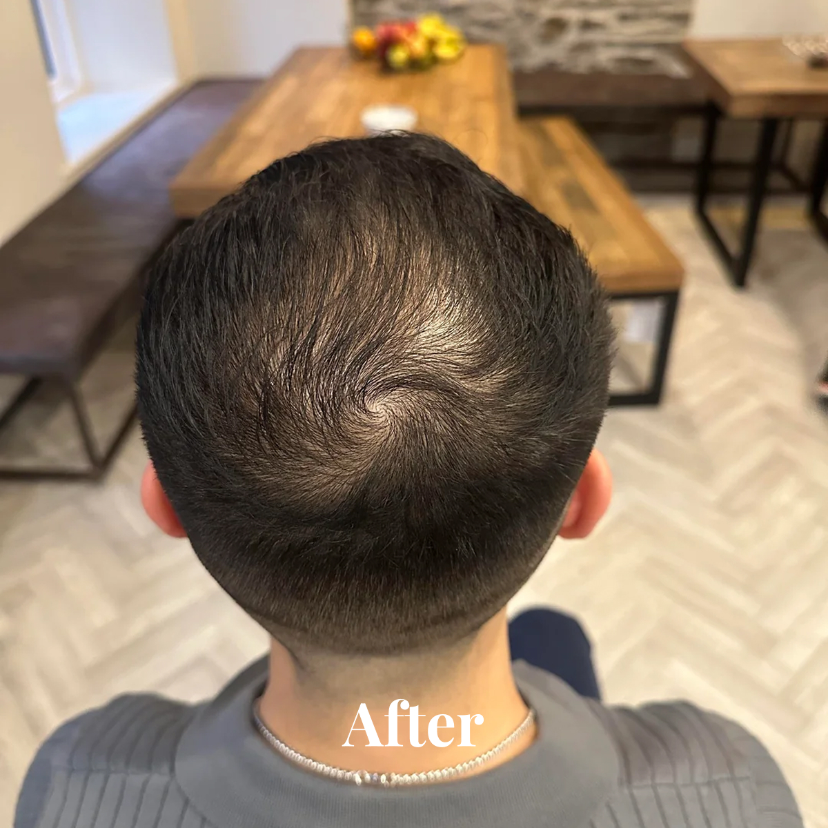 Top back view of a person's head showing neat, dark hair with a visible swirl pattern and clean fade haircut.