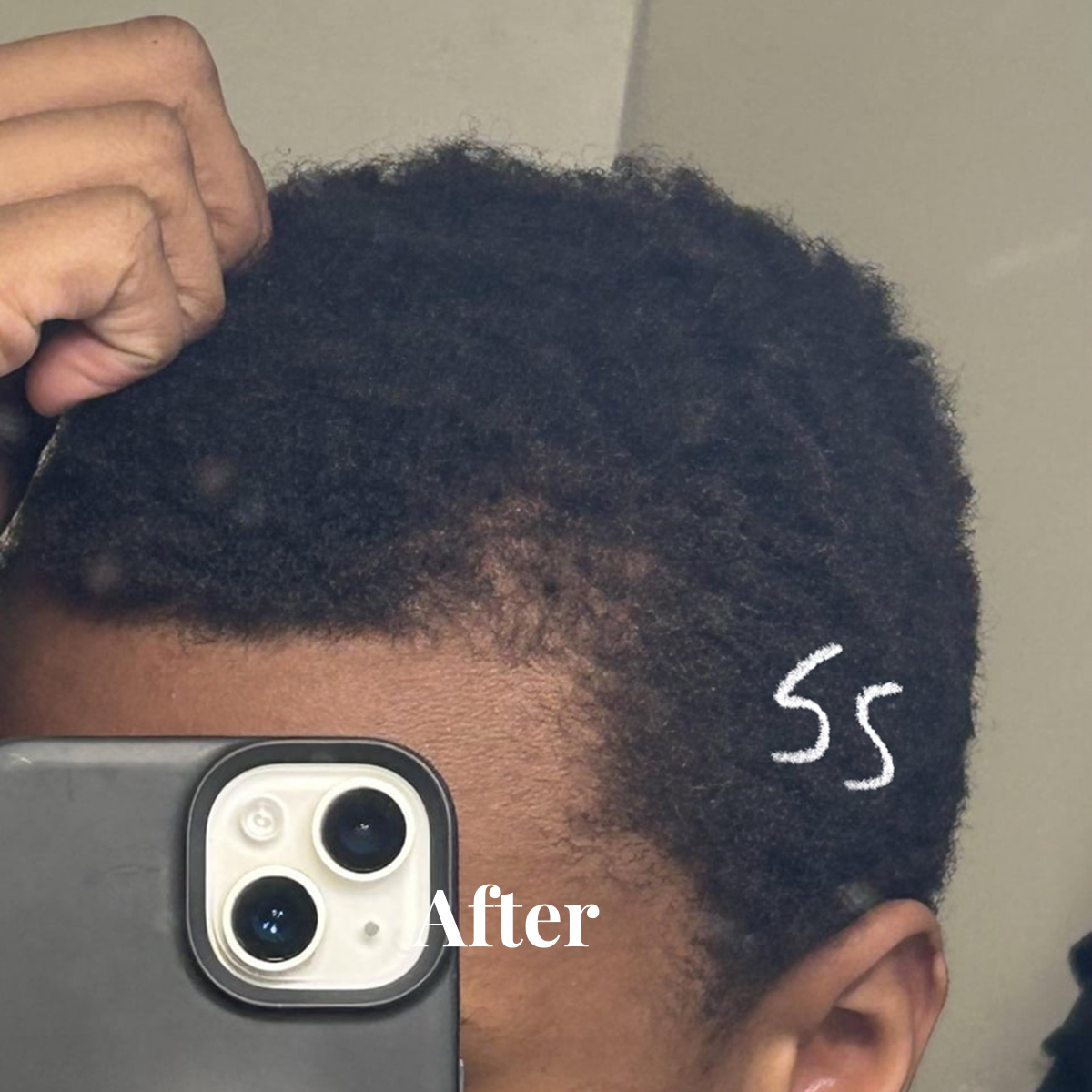Close-up of a person's head showing short, thick, curly hair with a hand pulling some hair back, phone camera visible, and text reading 'After' and '55'.