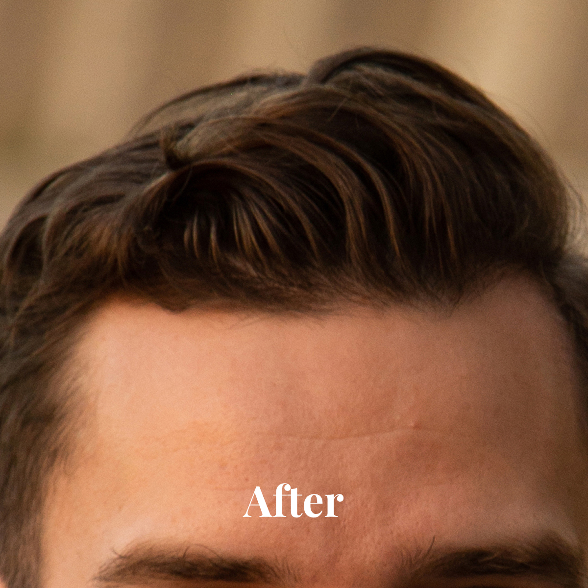 Close-up of a man's forehead and hairline with neatly styled dark brown hair labeled 'After'.