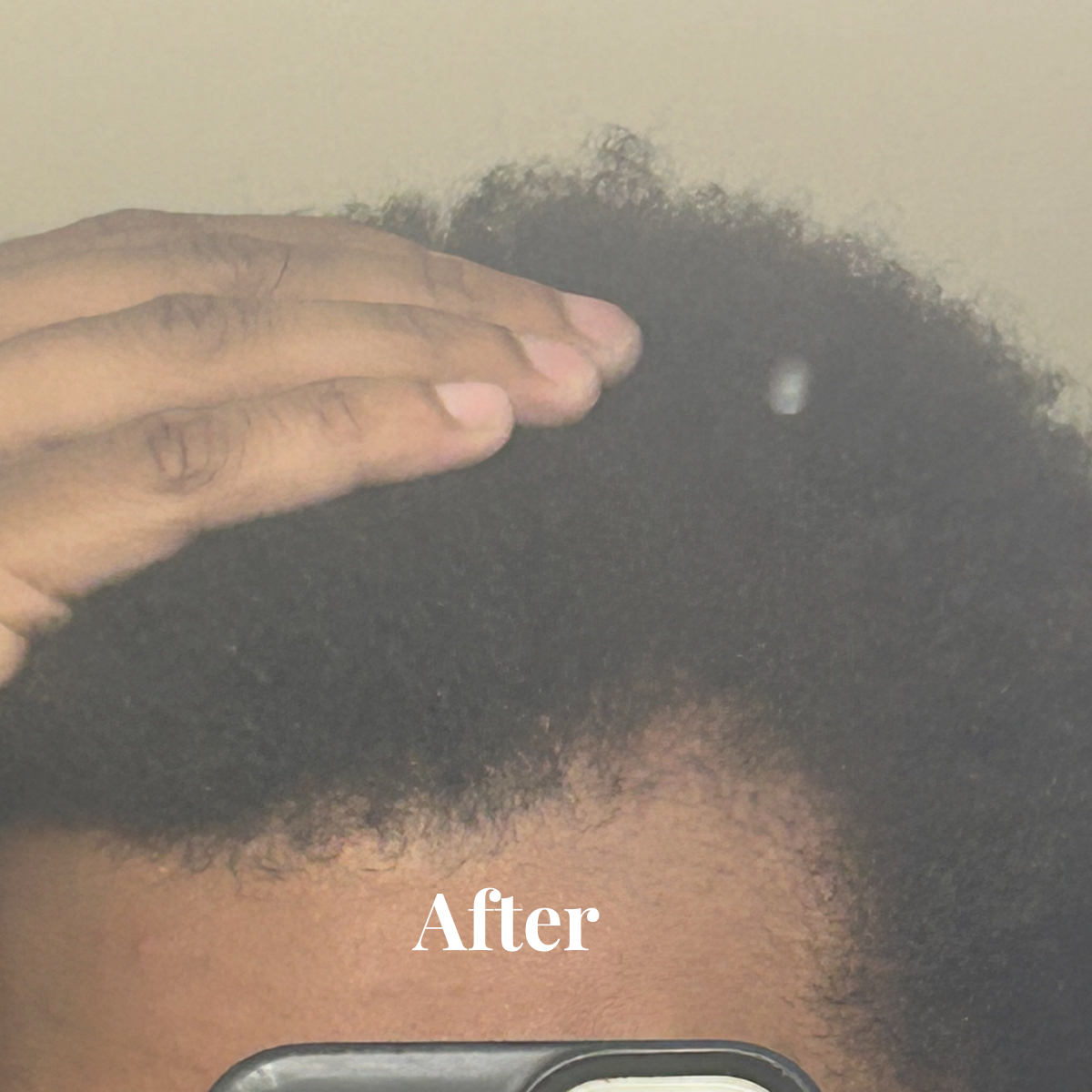 Close-up of a person touching the top of their natural curly hair, showing healthy hair texture, with the word 'After' overlaid.