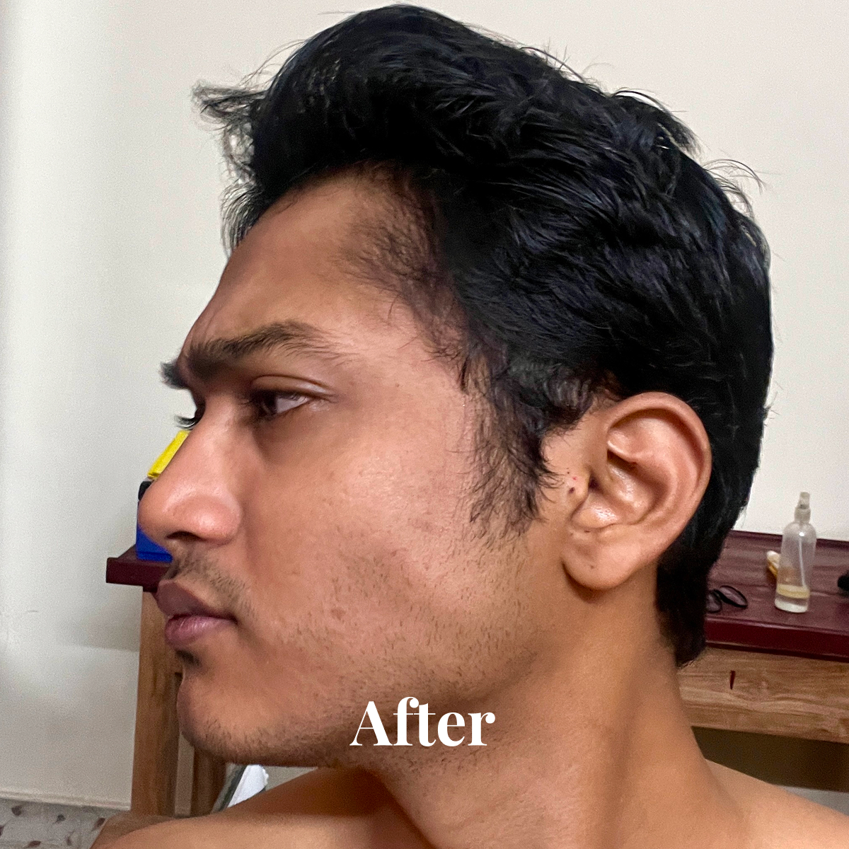 Side profile of a young man with neatly groomed hair and a clean-shaven jawline, with the word 'After' overlaid.