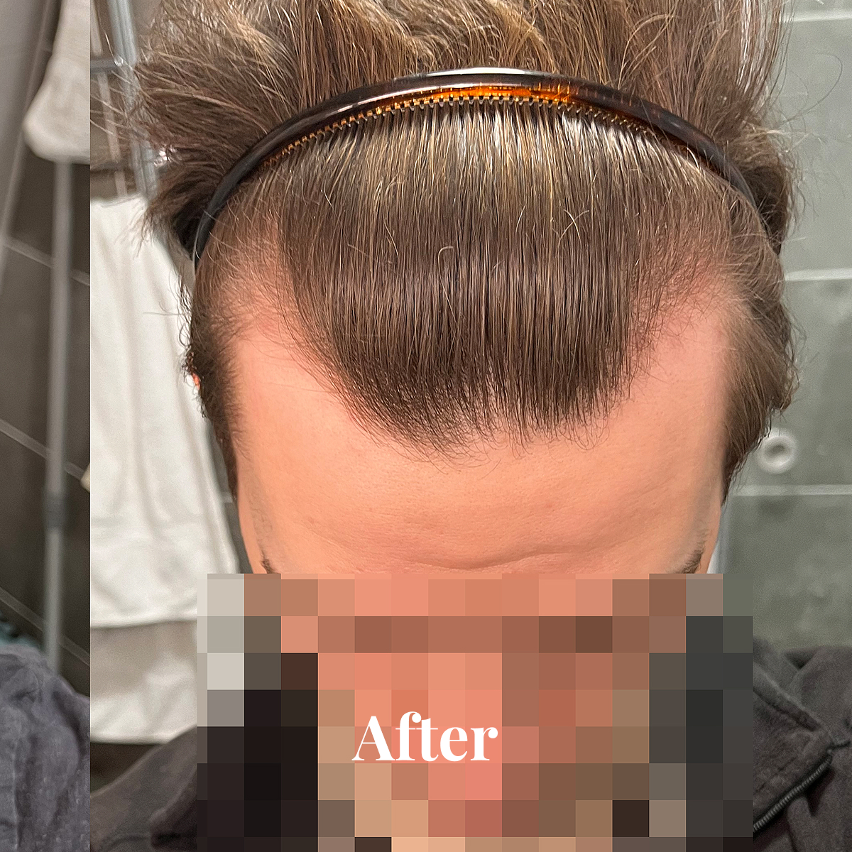 Top view of a person's head showing neatly combed brown hair held back with a thin translucent headband.