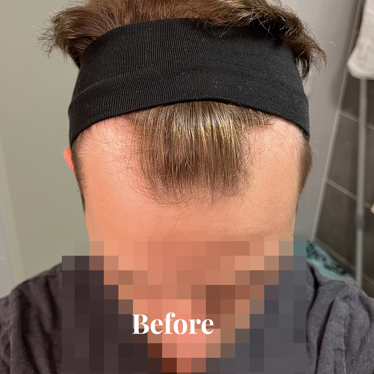 Top view of a person's forehead and hairline with a black headband holding back thin, light brown hair.