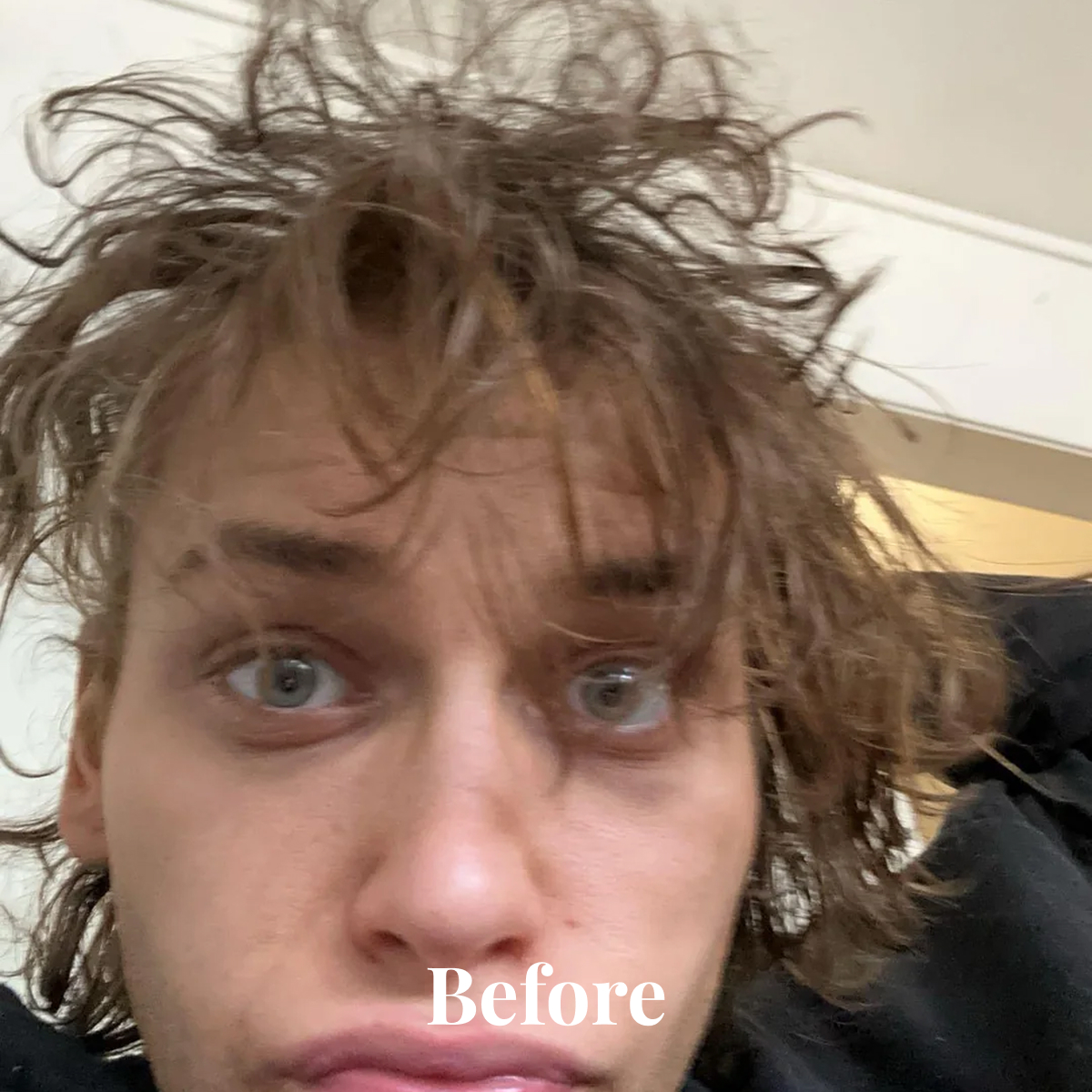 Close-up of a person with messy, tousled brown hair and a concerned facial expression, with the word 'Before' overlaid.