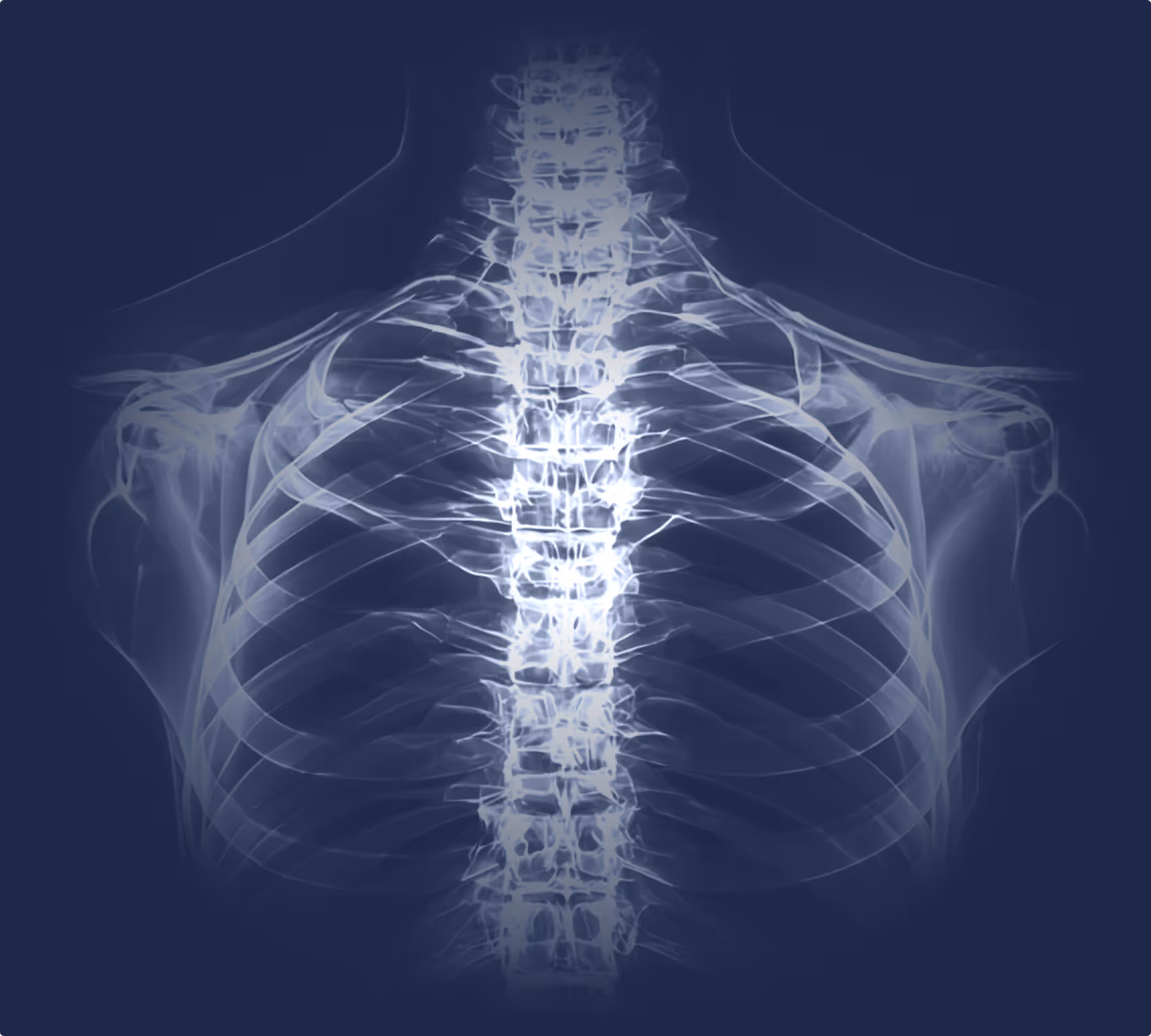 X-ray of ribs