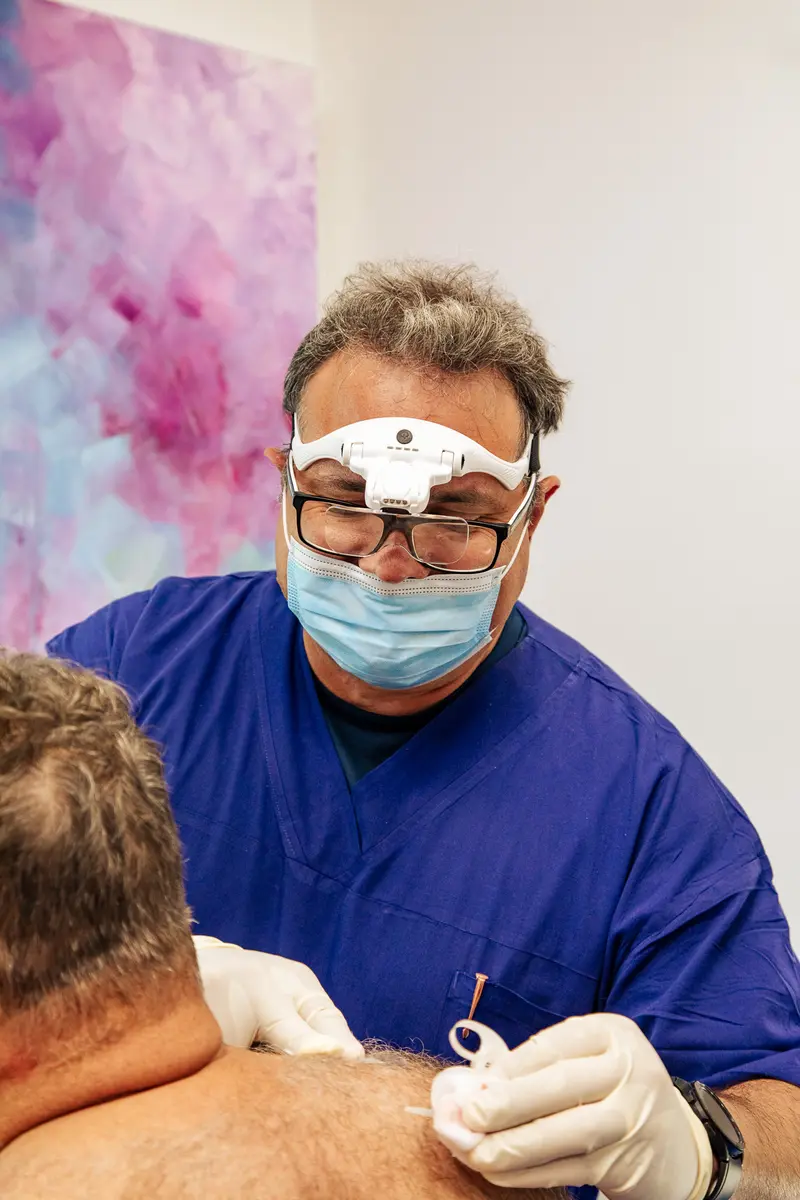Healthcare professional wearing a mask and magnifying glasses performing an acupuncture treatment on a patient's back.