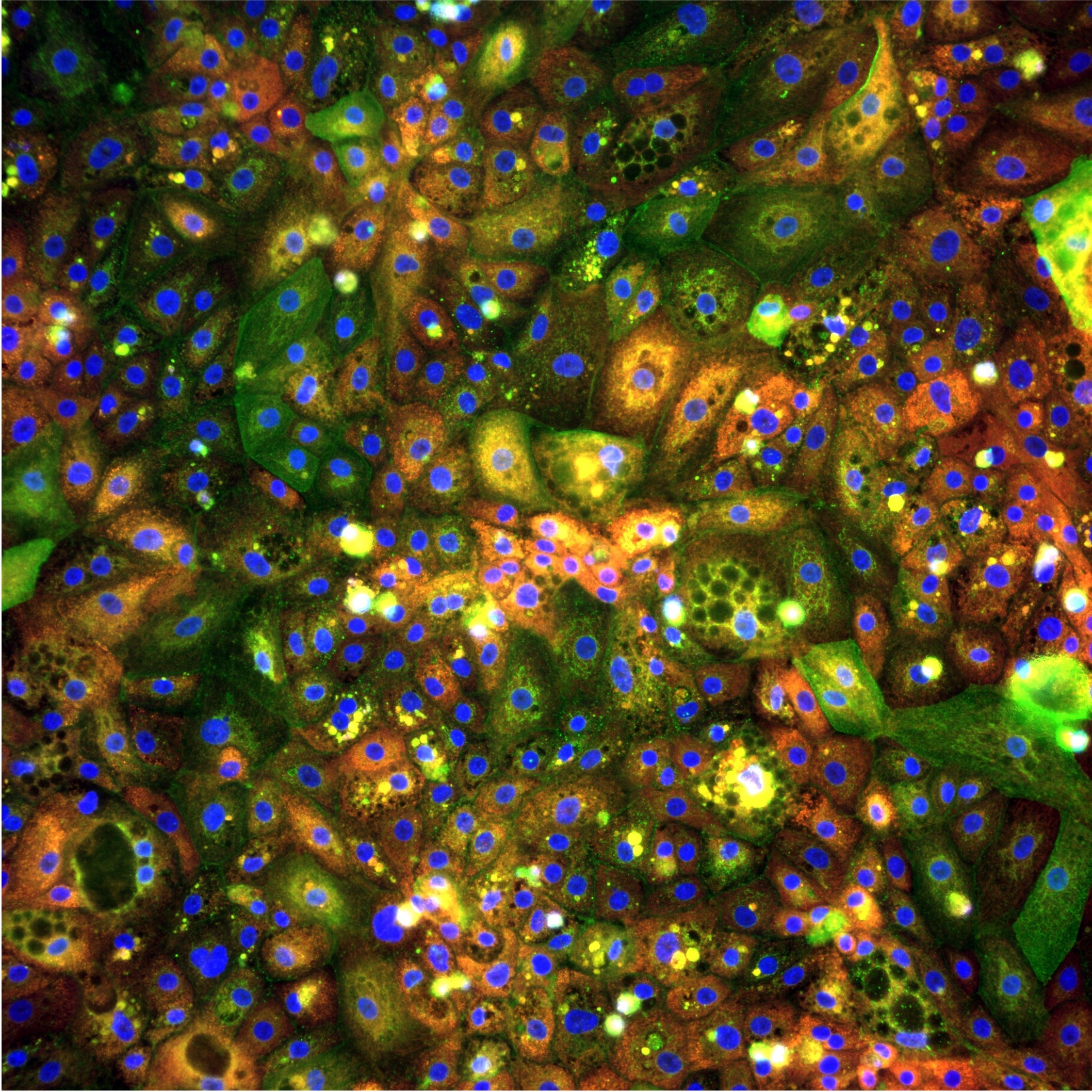 Scaling Phenotypic Toxicology: How We Use iPSC Hepatocytes and Foundation Models to Decode DILI 