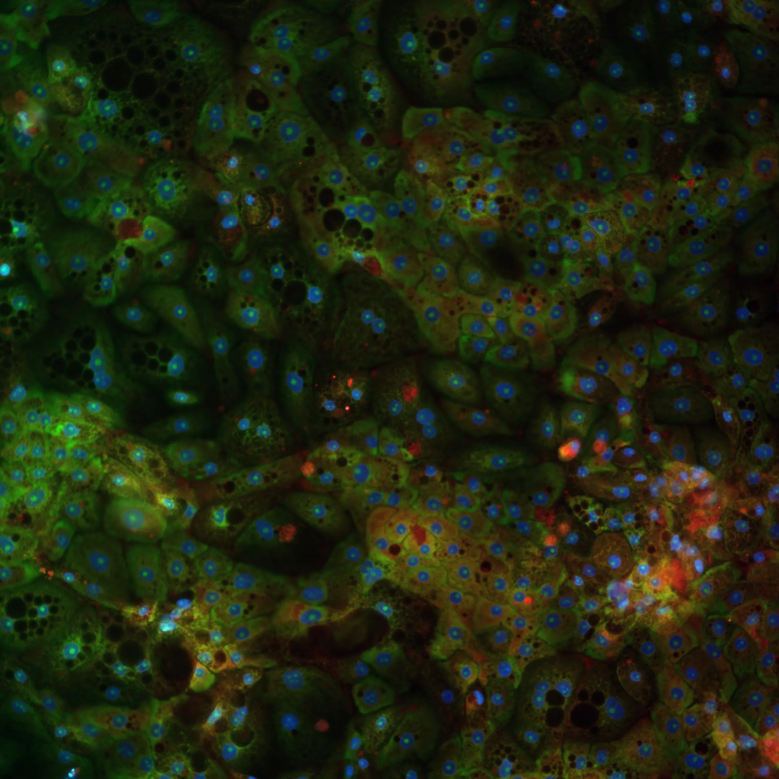 Cell Painting & Phenomics