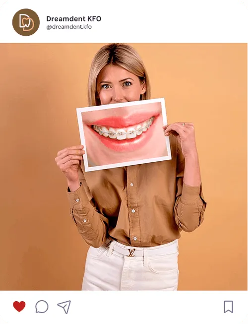 Eine Frau hält ein Foto mit einem lächelnden Mund mit Zahnspange vor sich hoch.