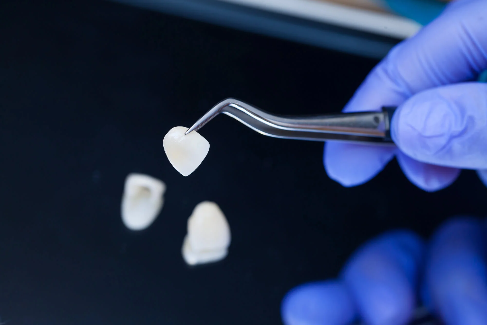Dentist holding tools for dental veneers in Philadelphia.