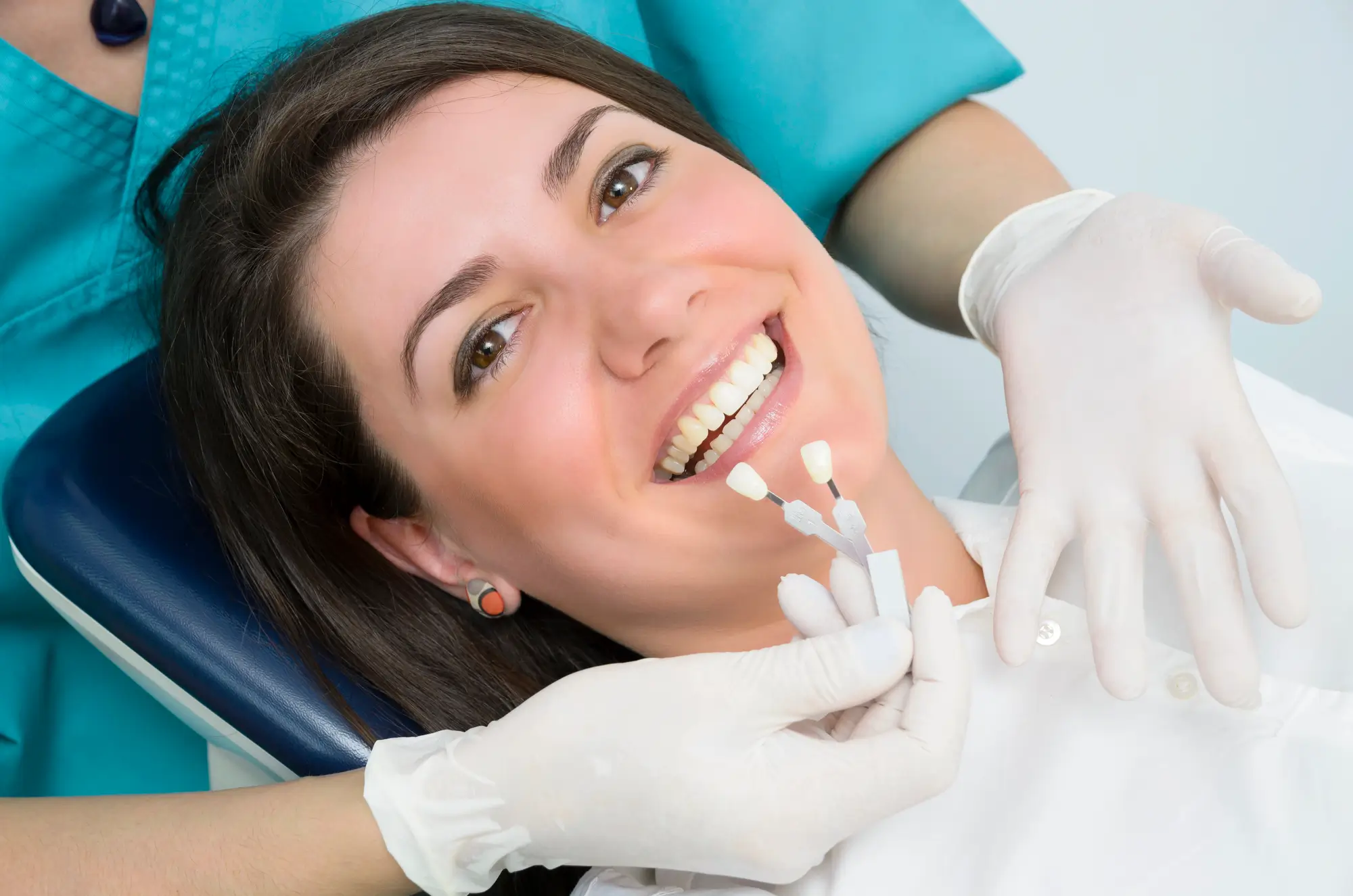 Teeth whitening Philadelphia with porcelain teeth result