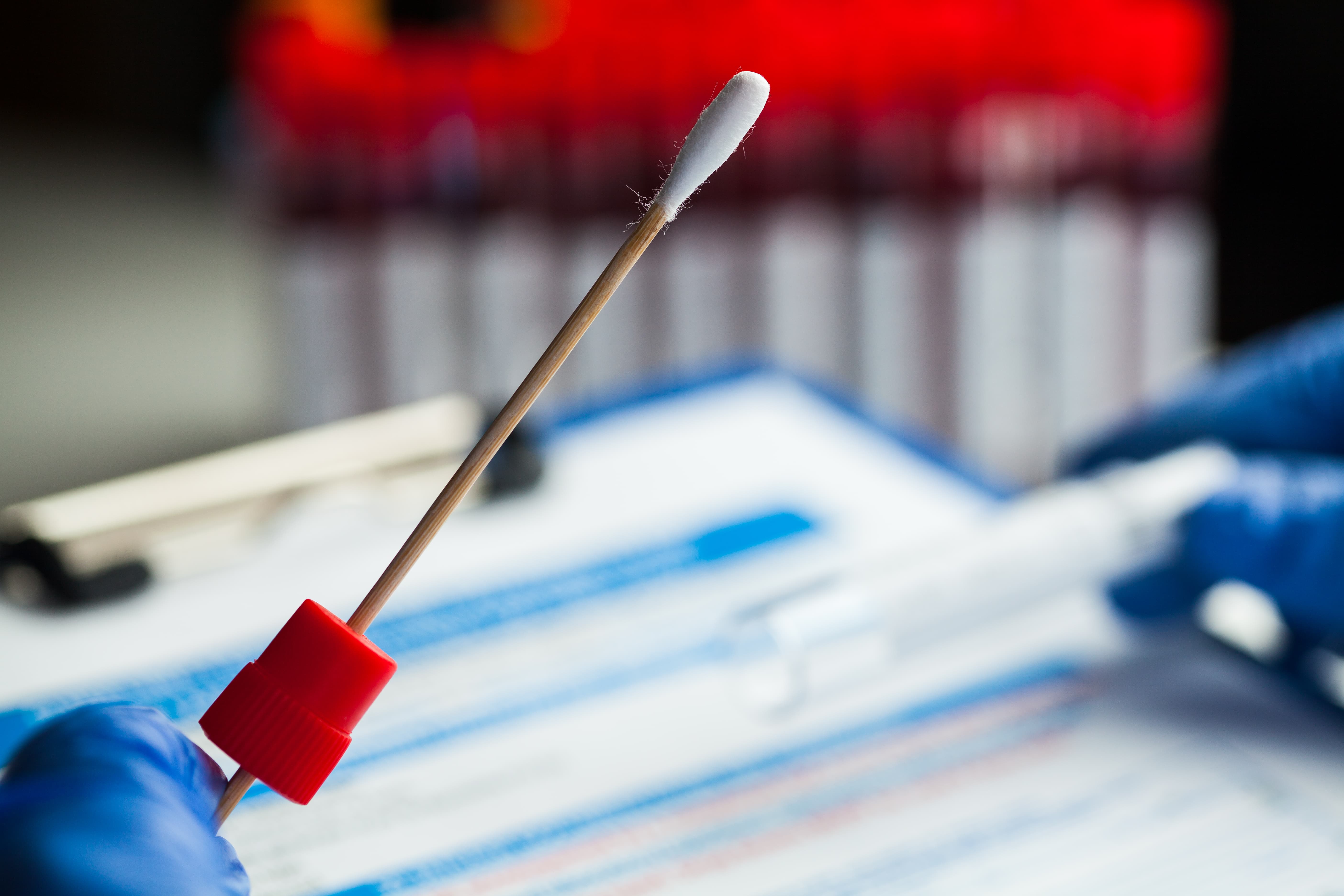 At home stool testing kit