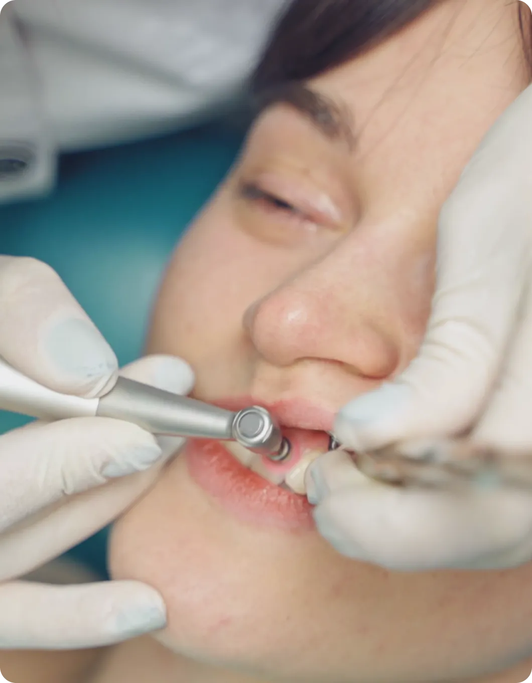 A woman getting her teeth checked by a dentist.