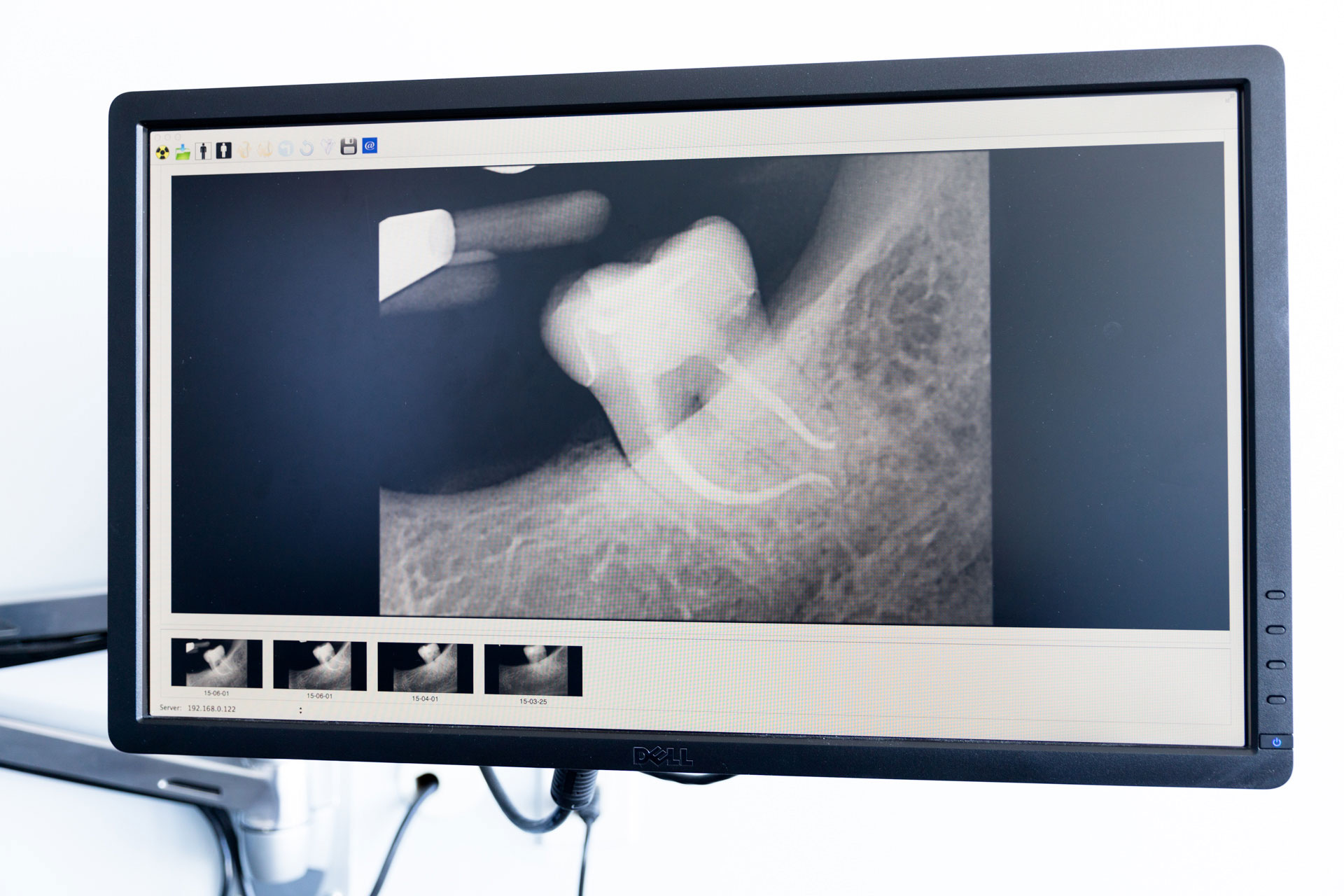 Dental scan on a screen