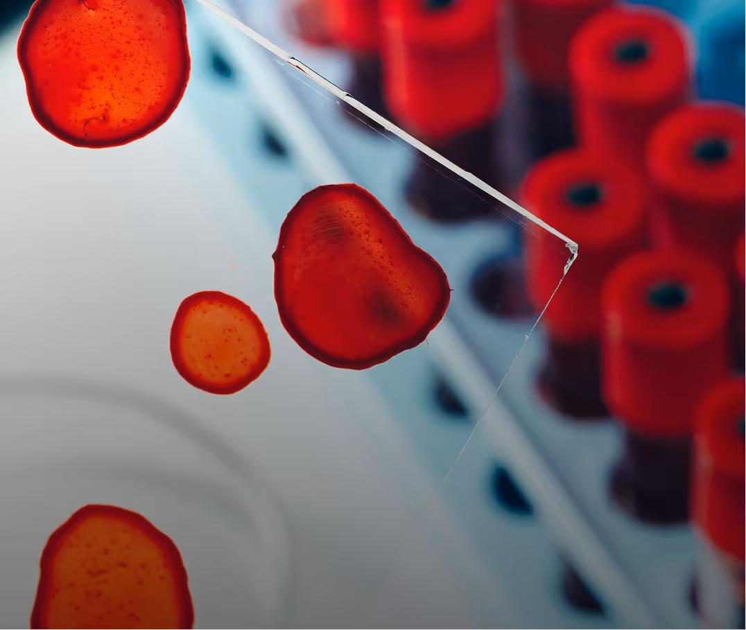 Red blood cells floating near a cracked glass slide with blurred red tube caps in the background.