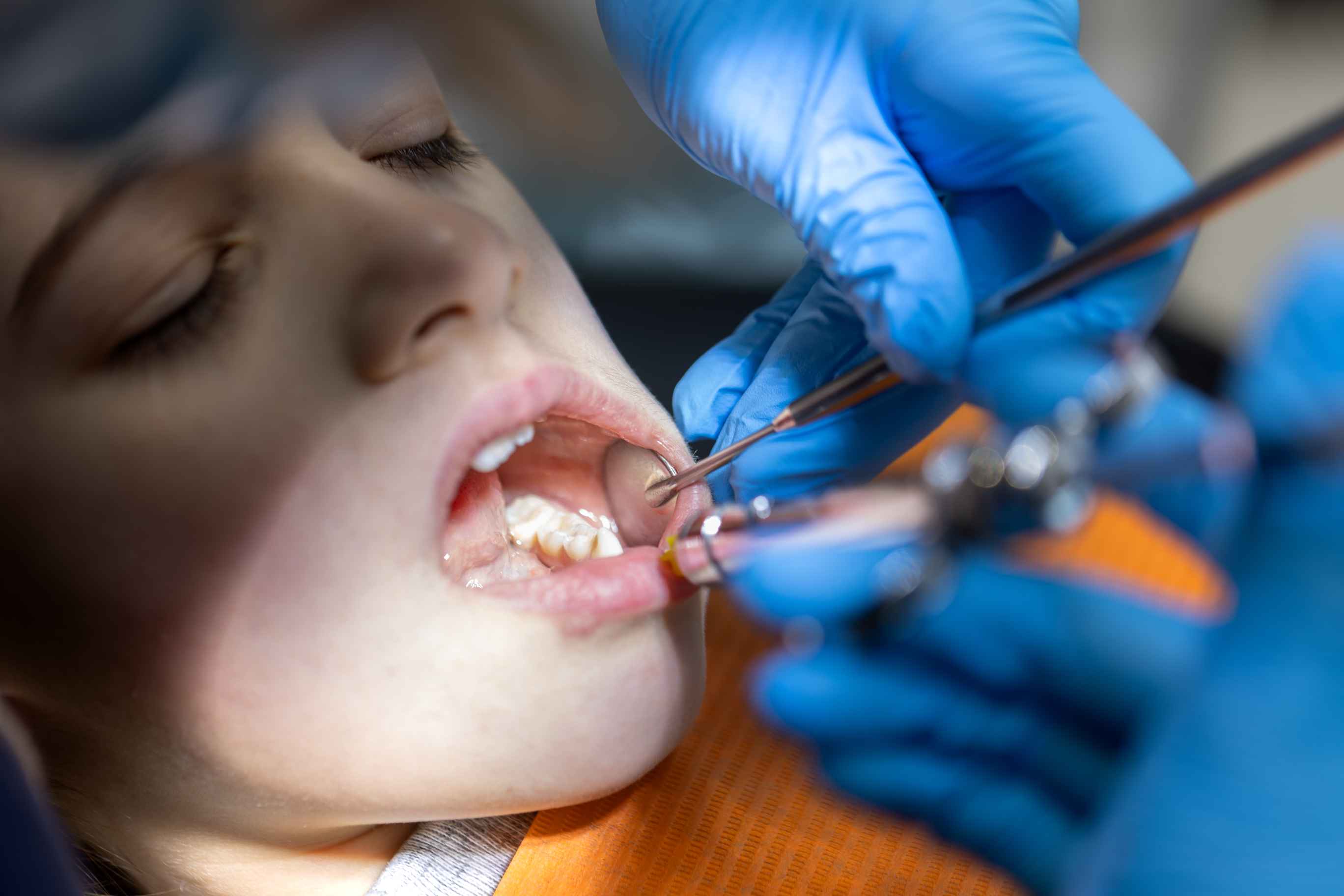 Child receiving dental examination with dental mirror and tool held by gloved hands.