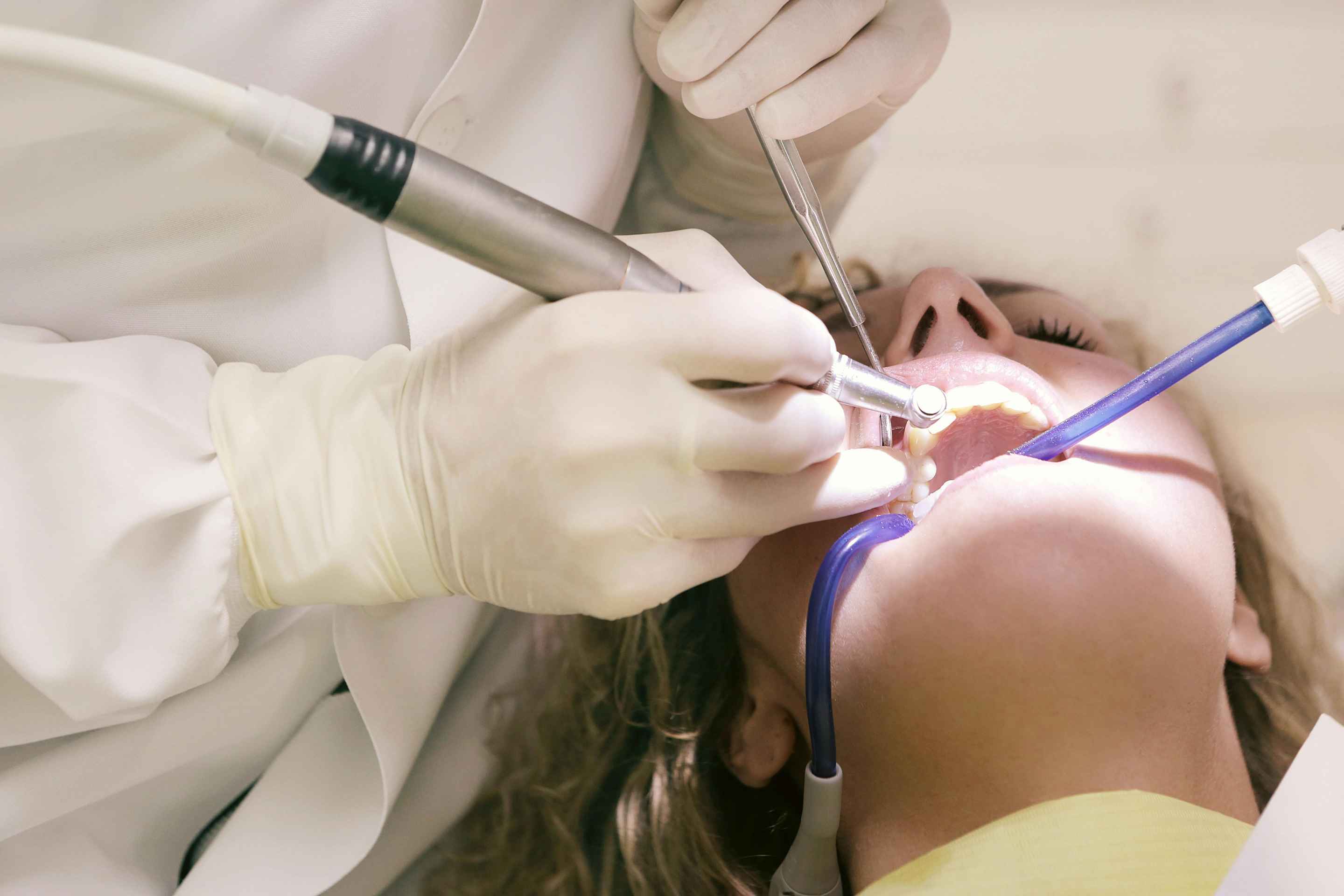 Dentist wearing gloves performing dental treatment on a patient's open mouth using dental tools and a suction device.