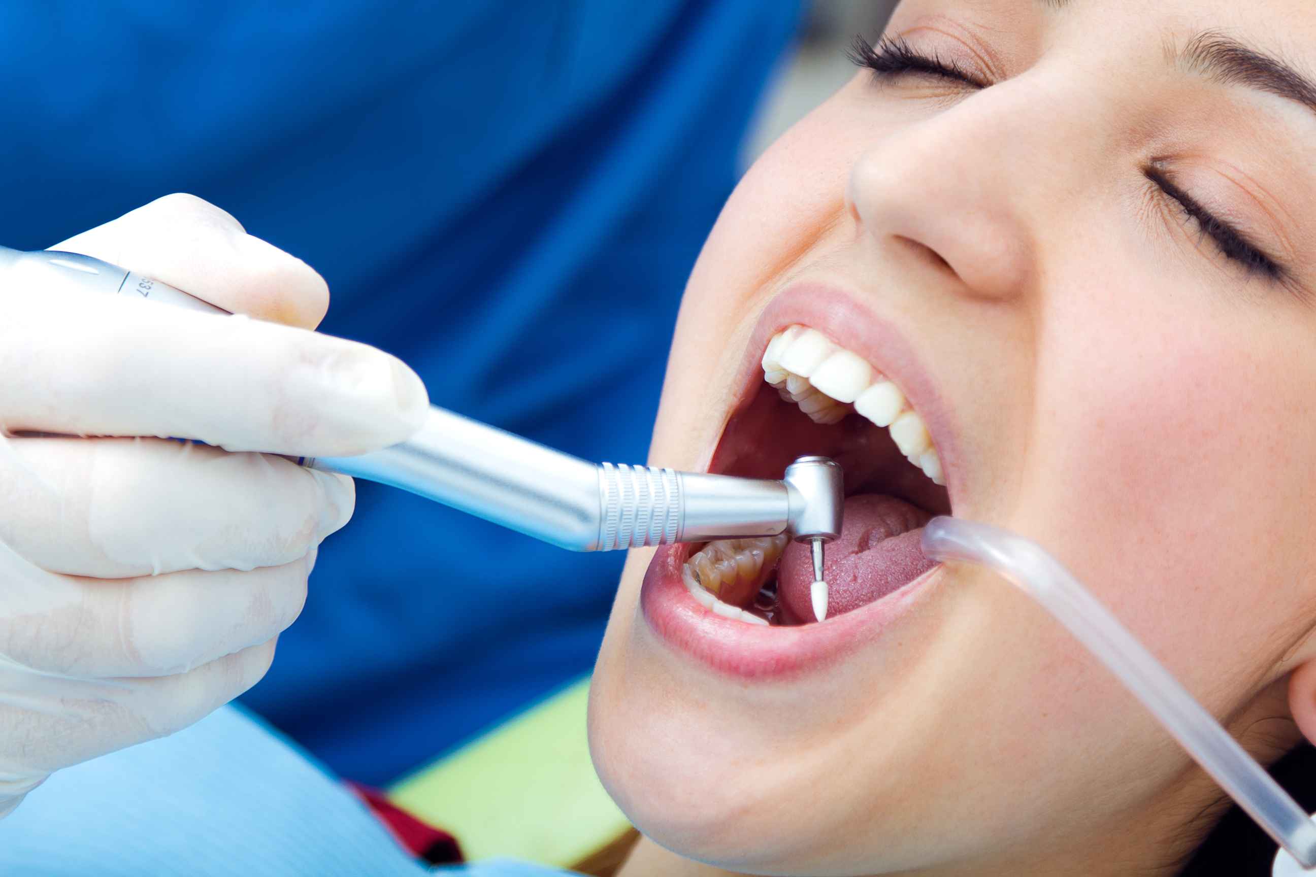 Close-up of a dental procedure with a gloved hand using a dental drill inside a patient's open mouth.
